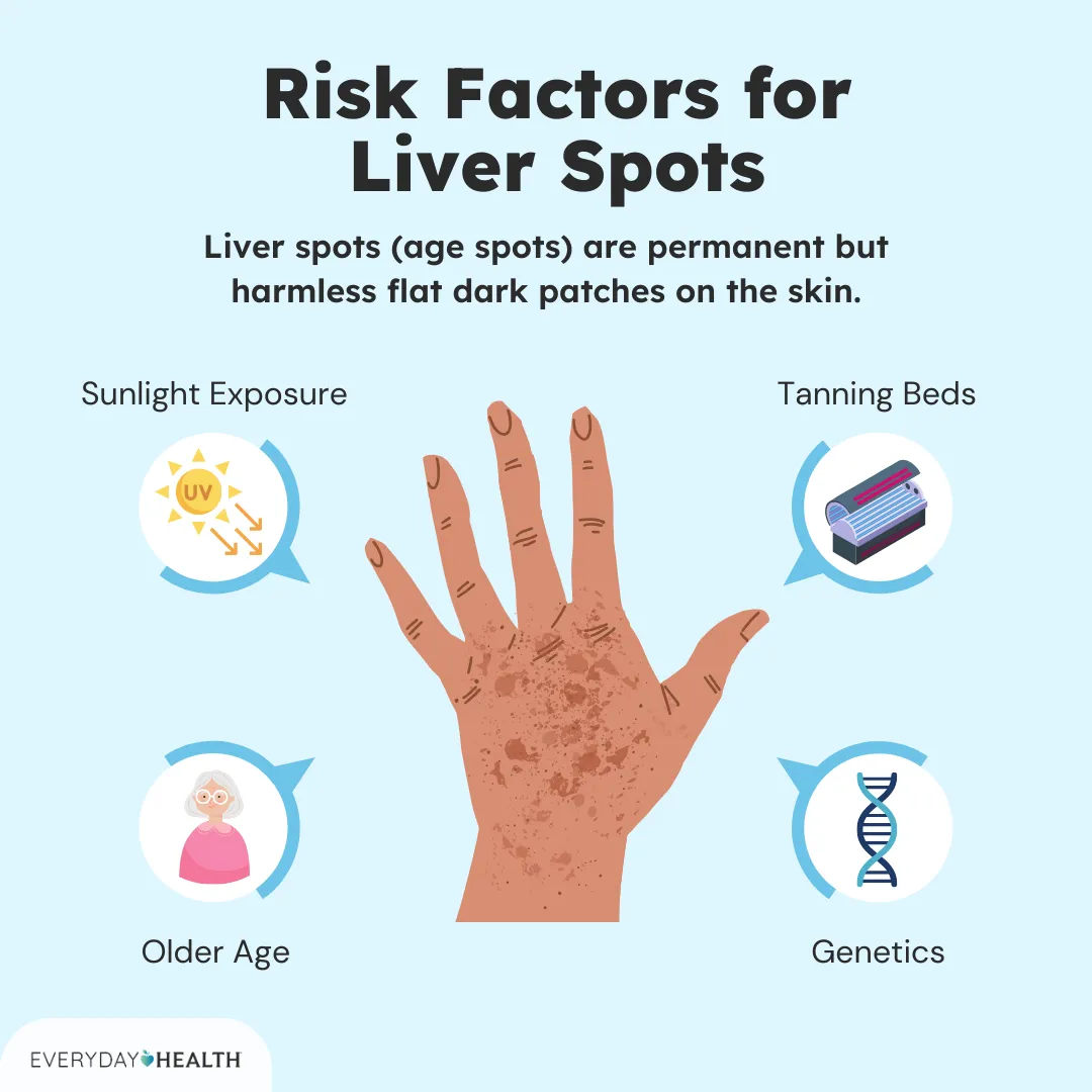 Spots On Liver