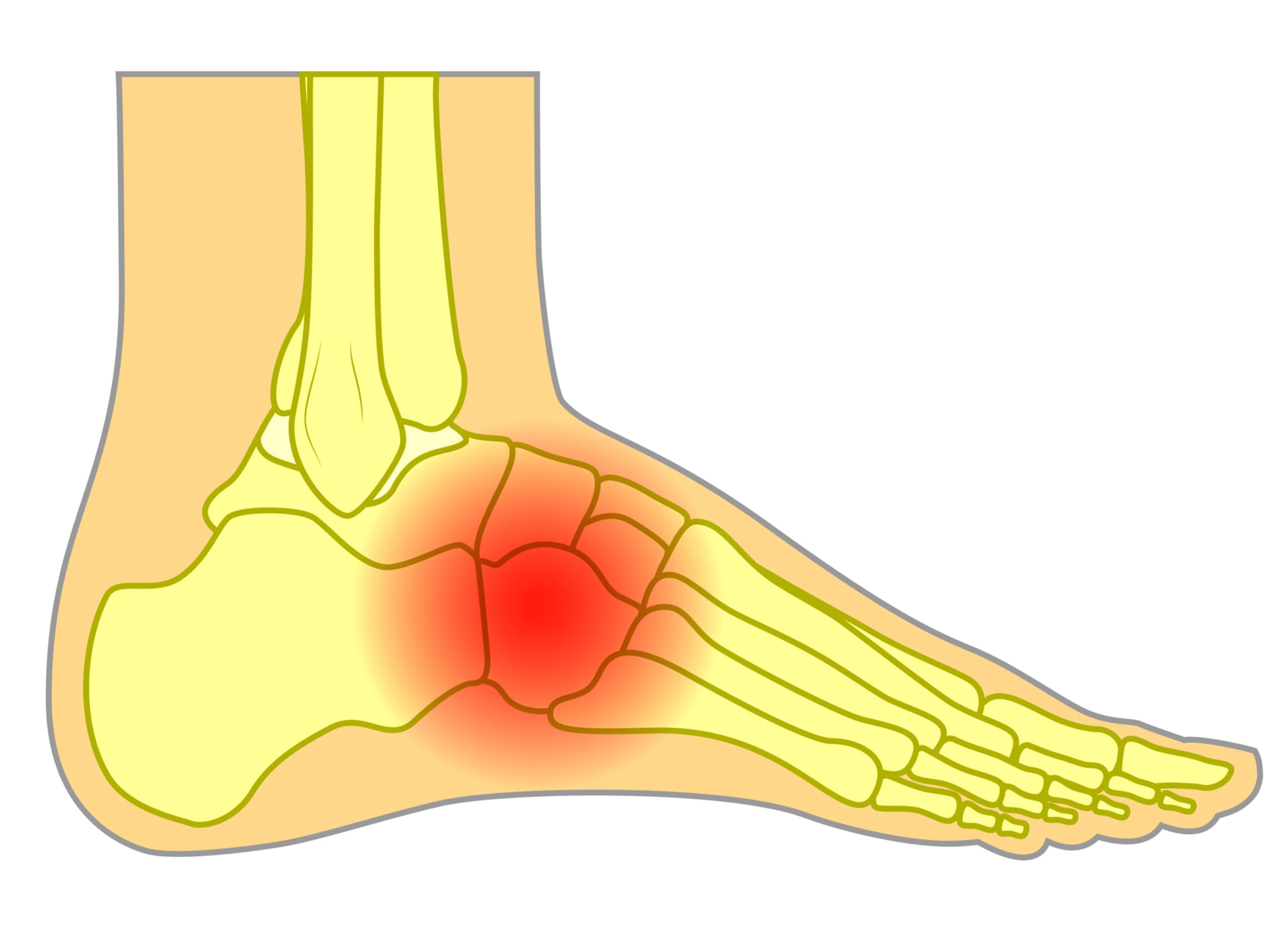 Sprained Toe Symptoms