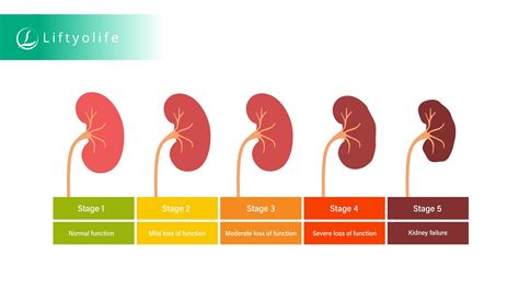 Stage 3 Kidney Disease Symptoms