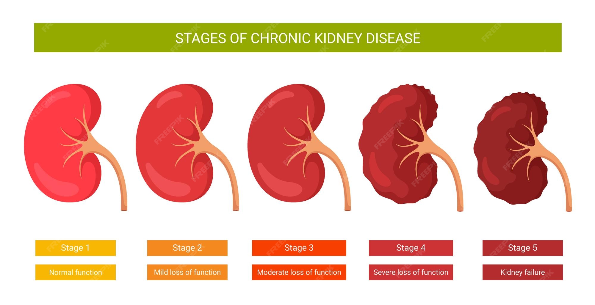 Stage Four Kidney Disease