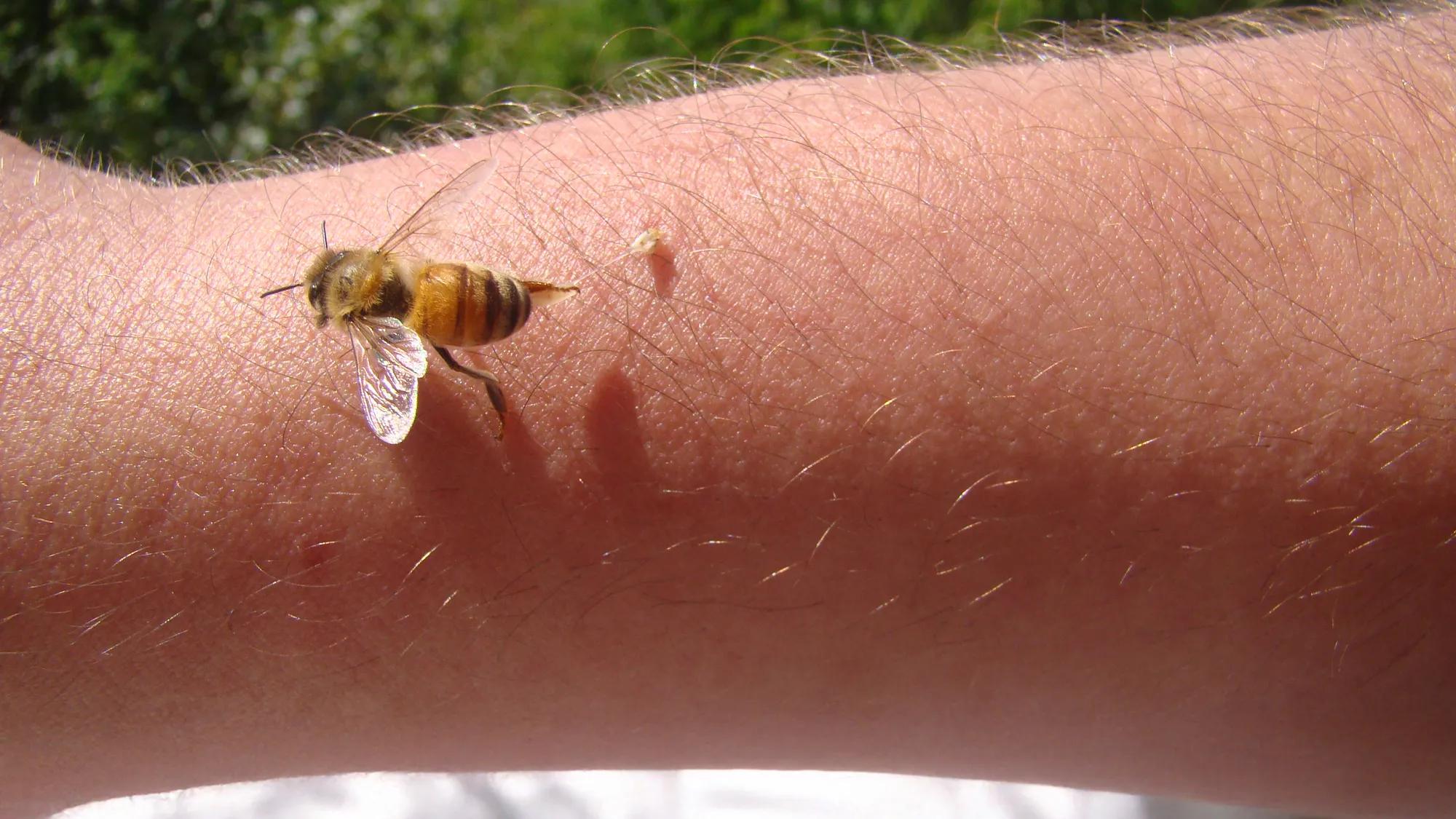 Sting Of Queen Bee