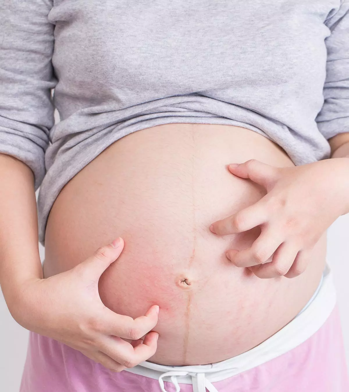 Stomach Itching While Pregnant