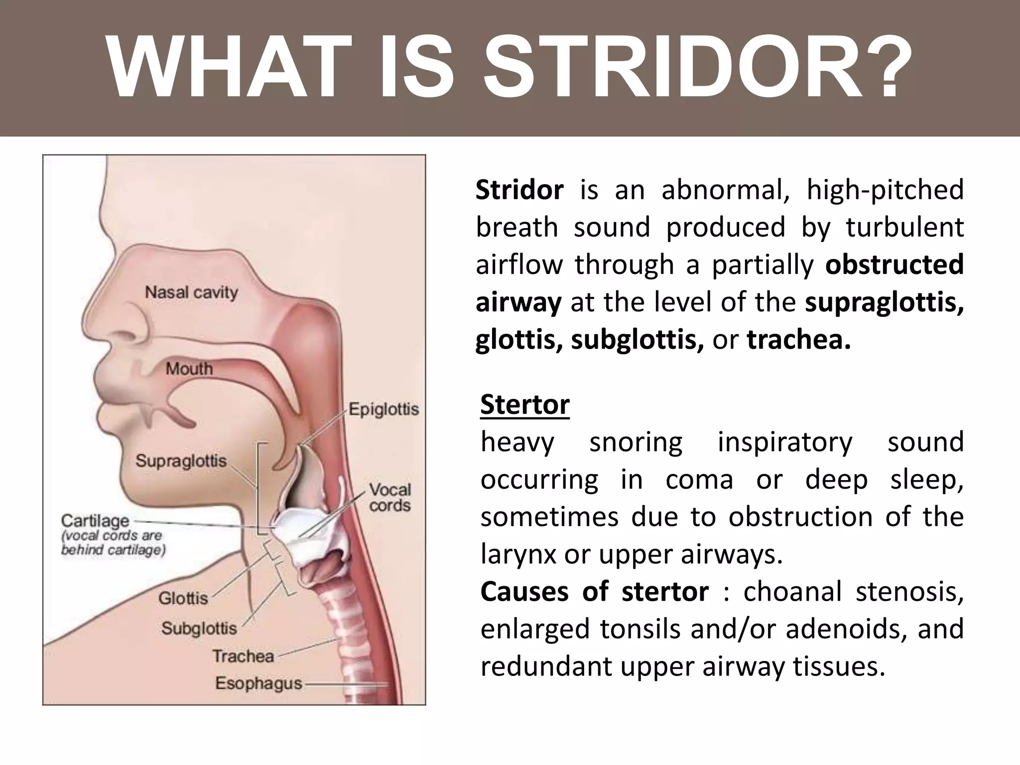 Stridor Vs Stertor