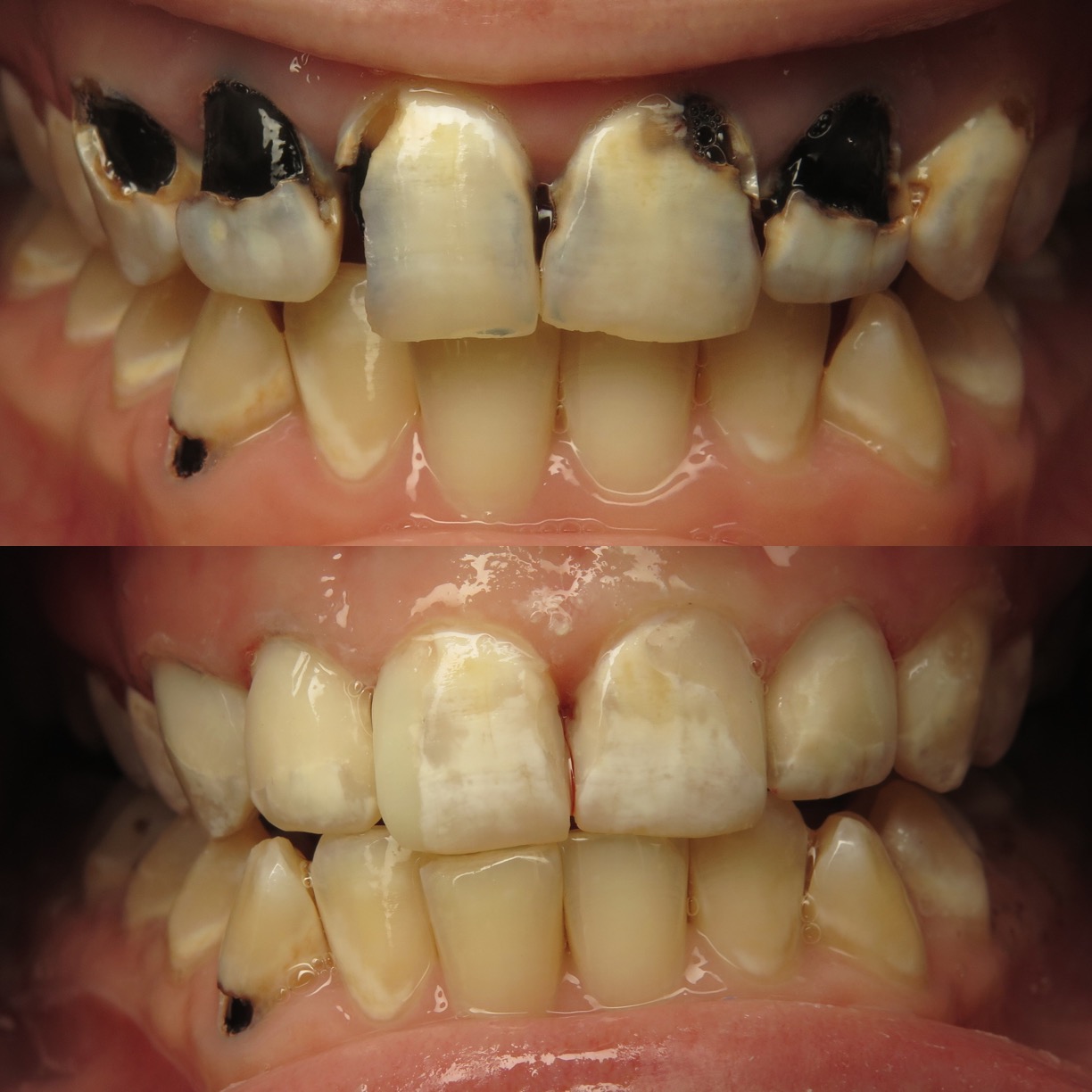 Sugary Love Onlyfans Leak