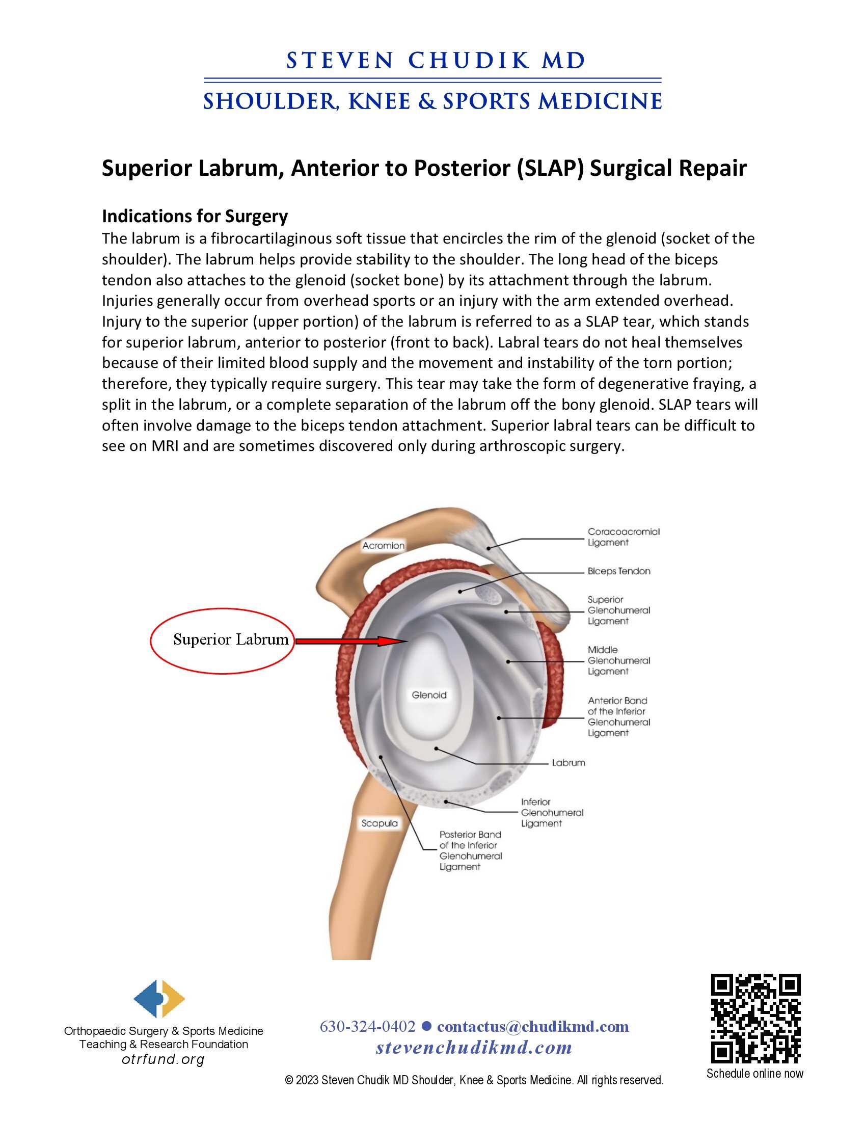 Superior Labral Anterior Posterior