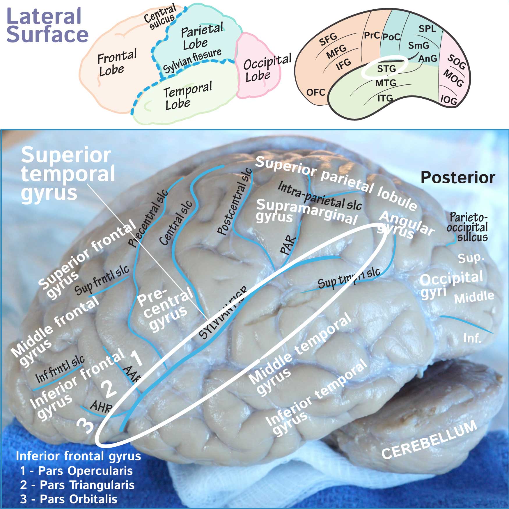 Superior Temporal Gyrus