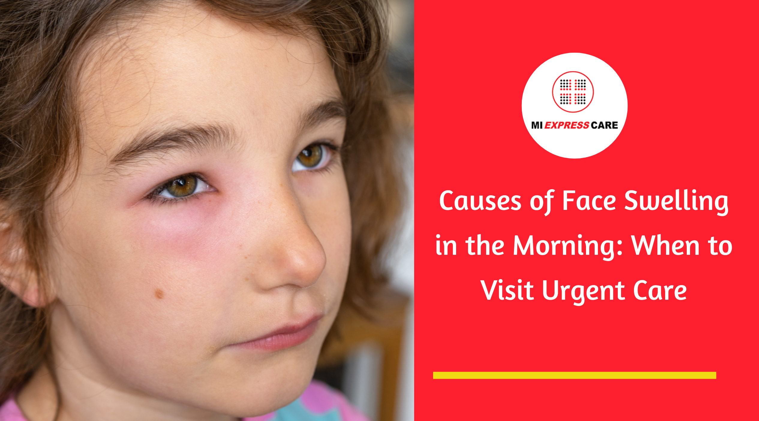 Swelling Face One Side