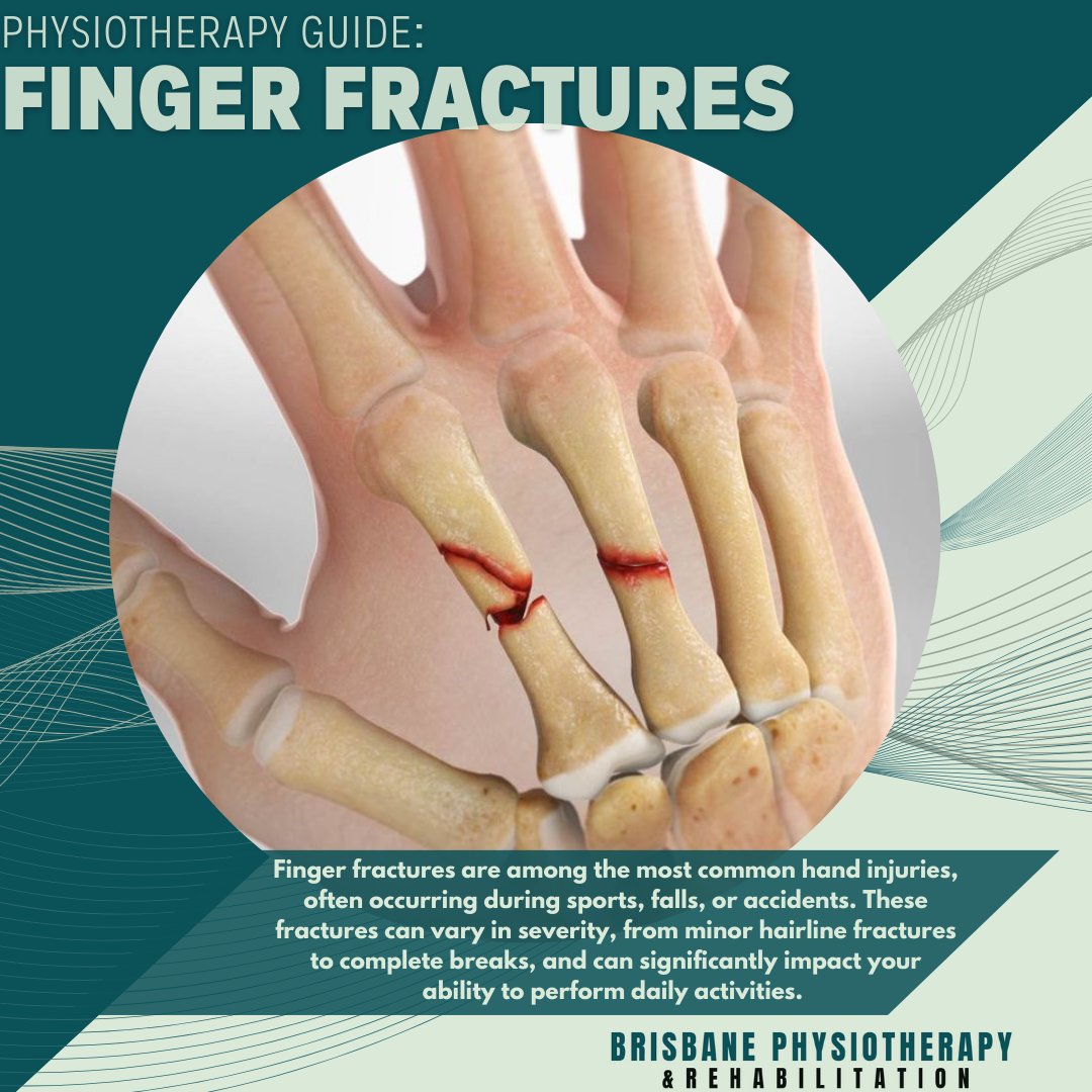 Symptoms For A Broken Finger