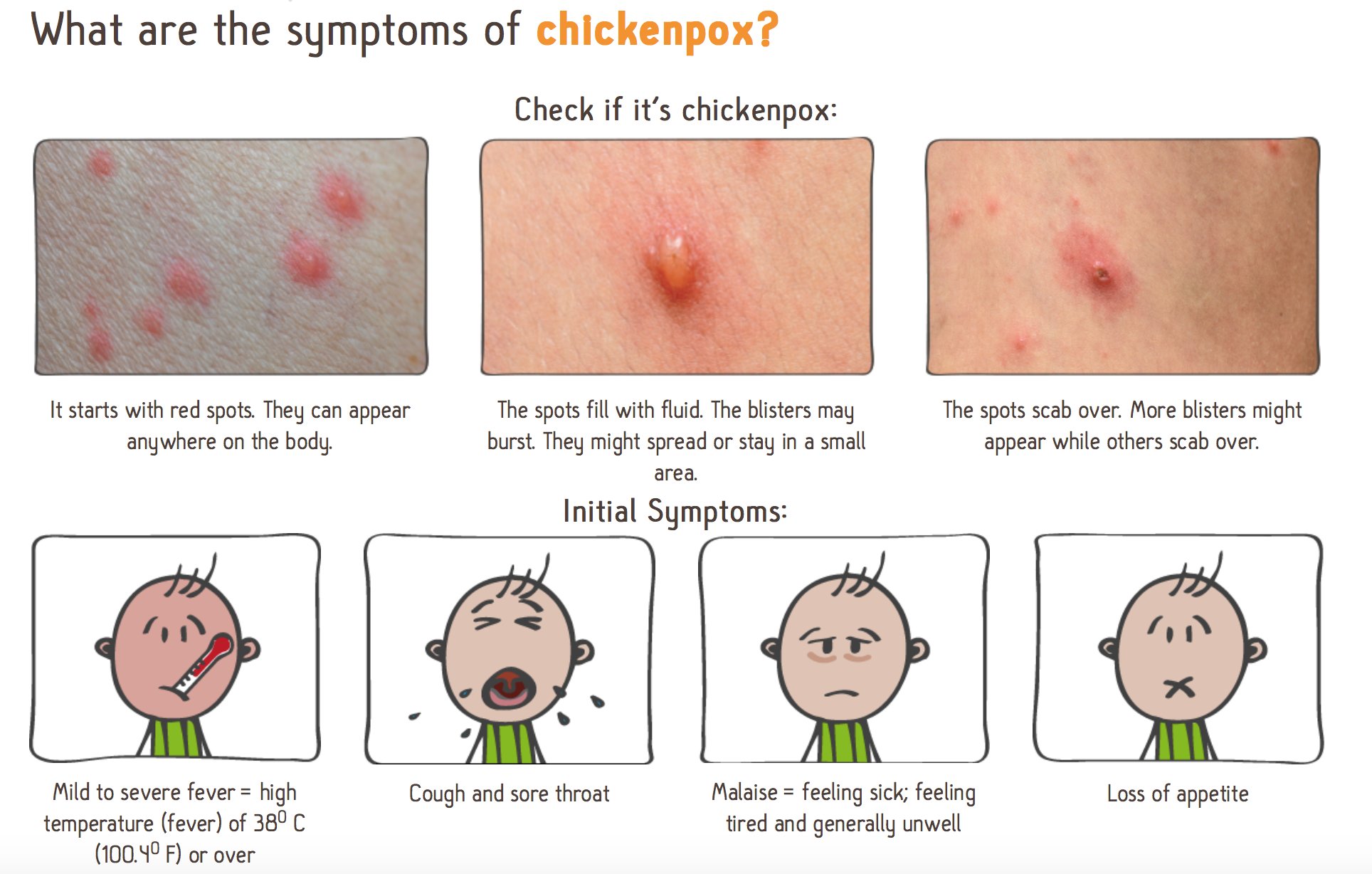 Symptoms Of Chicken Pox