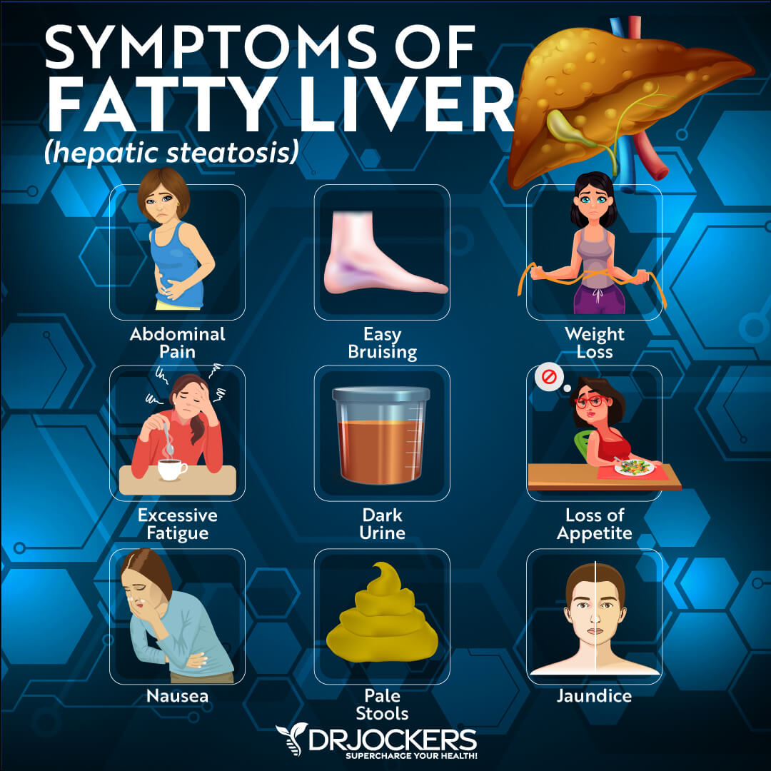 Symptoms Of Fatty Liver