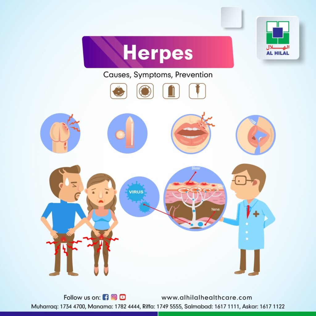 Symptoms Of Herpes