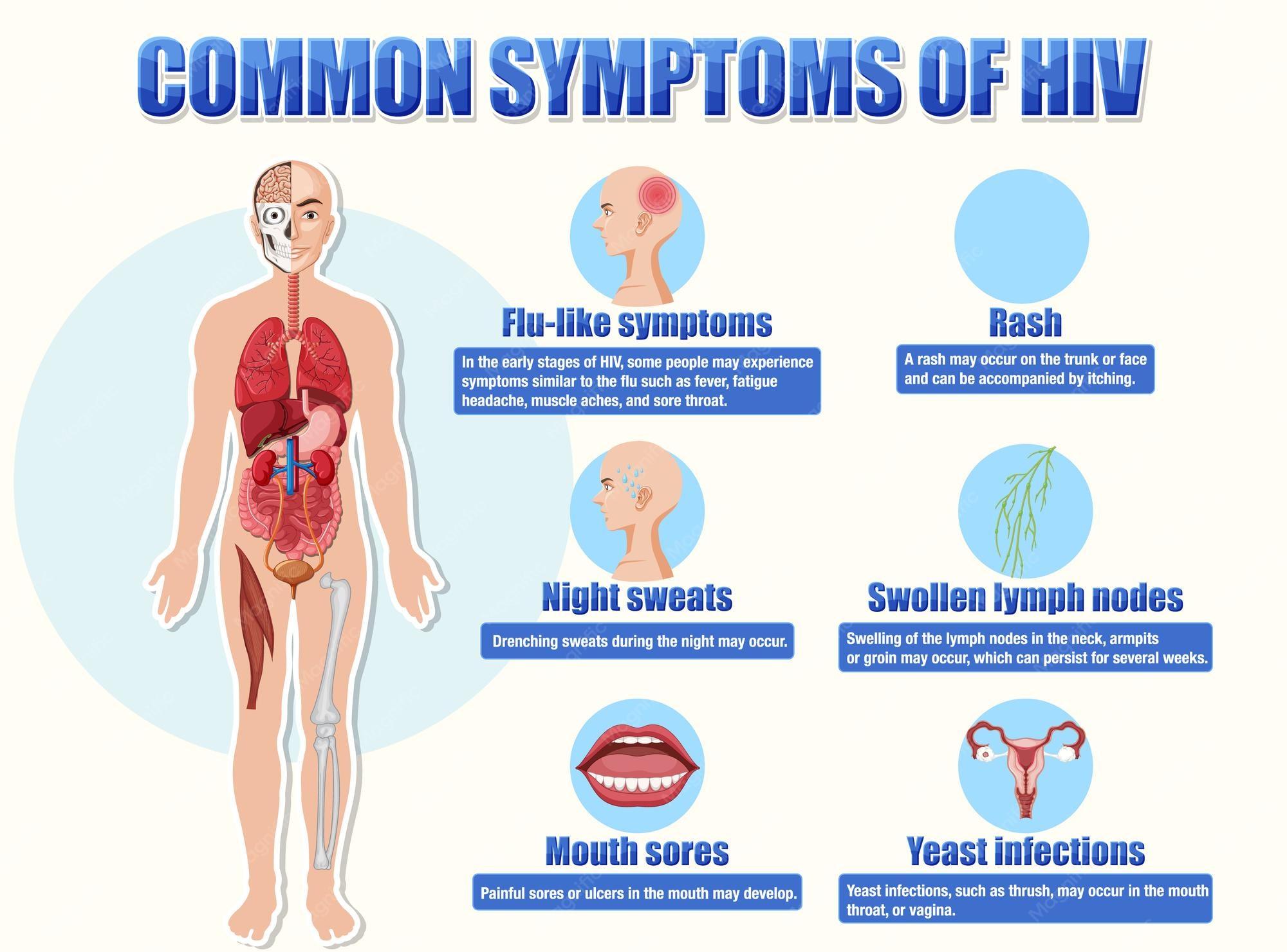 Symptoms Of Hiv