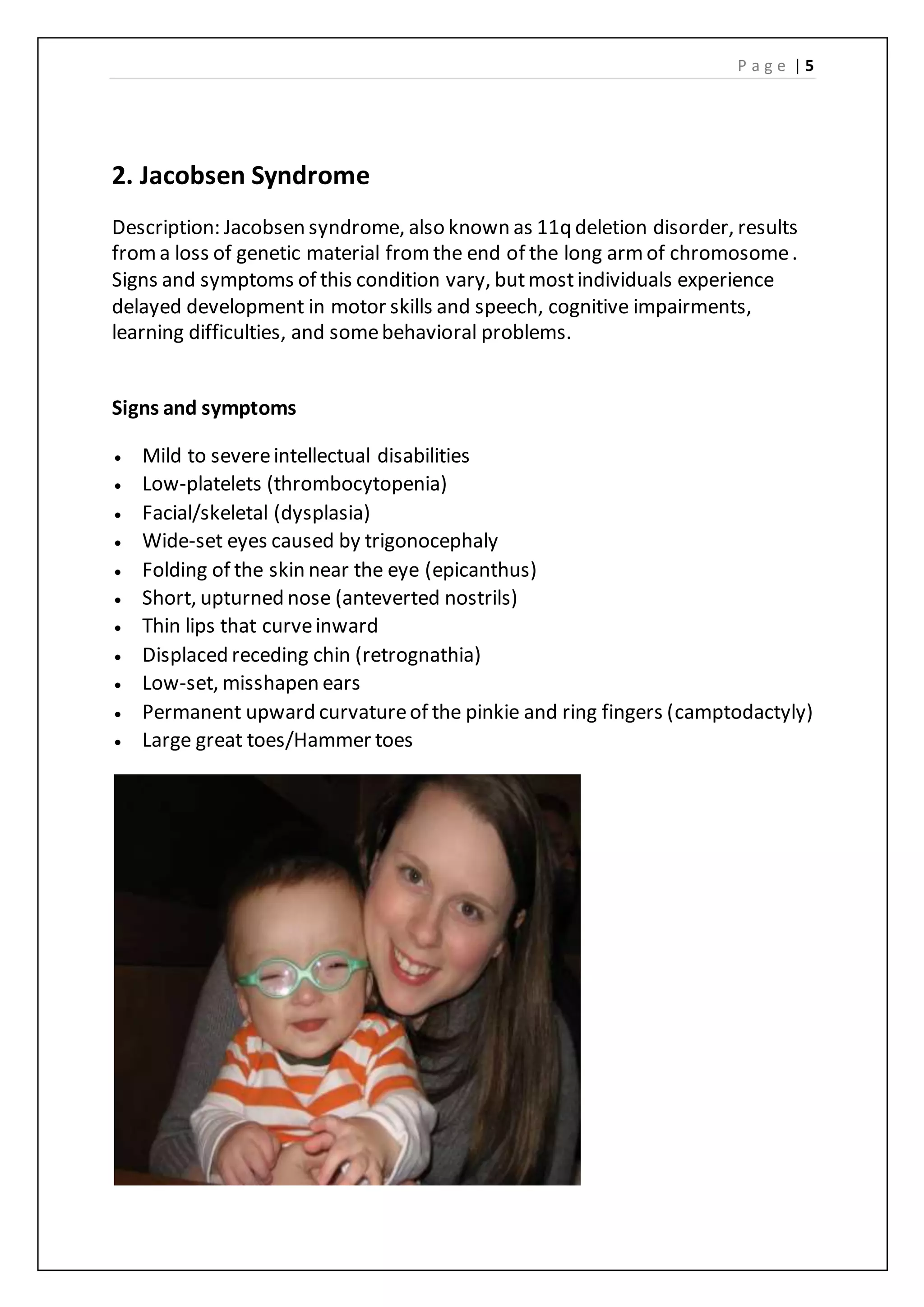 Symptoms Of Jacobsen Syndrome