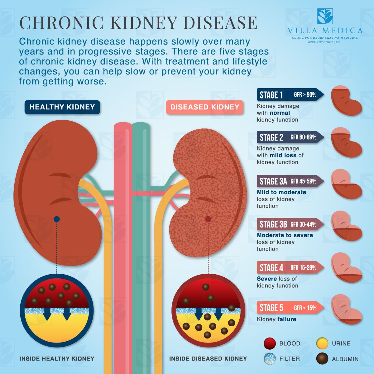Symptoms Of Kidney Damage