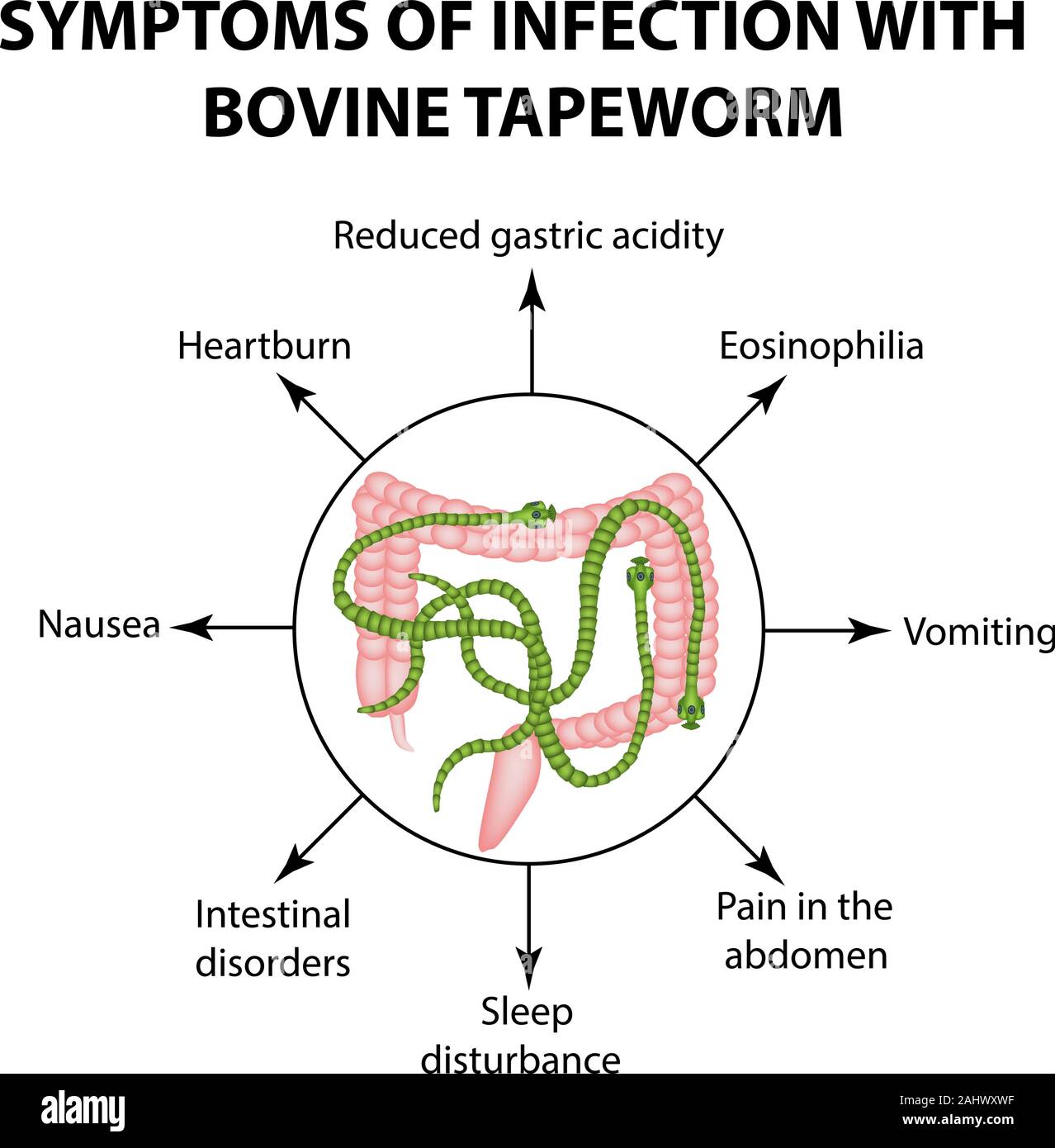 Symptoms Of Tapeworm Infestation