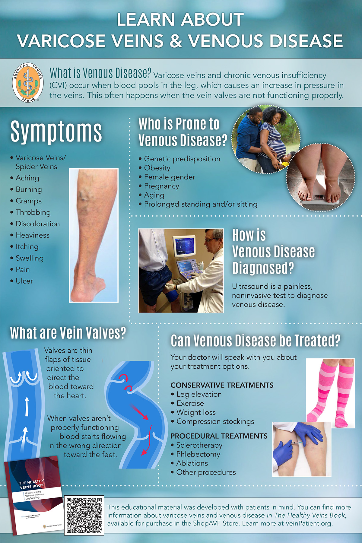 Symptoms Of Venous Disease