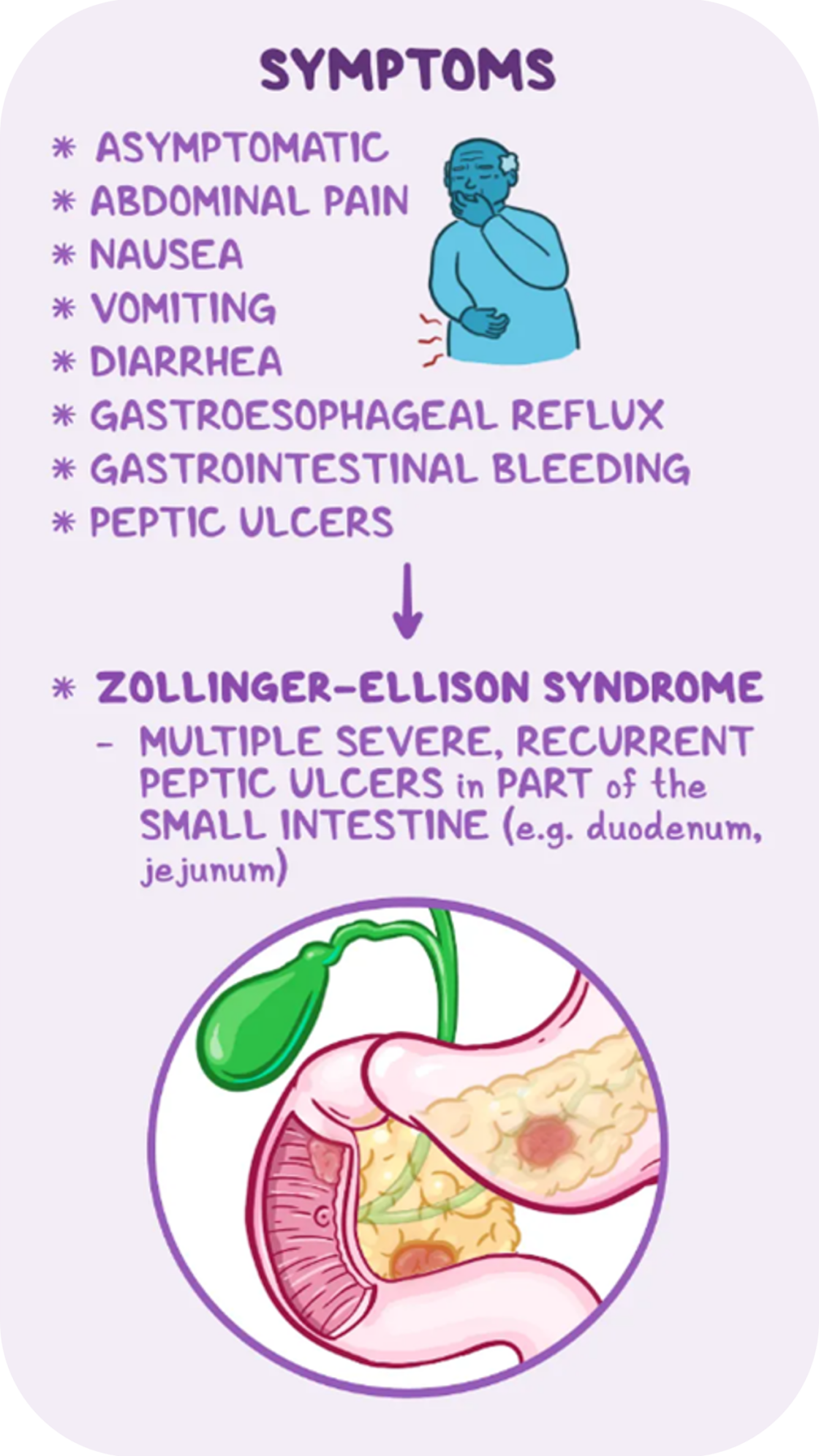 Symptoms Of Zollinger Ellison Syndrome