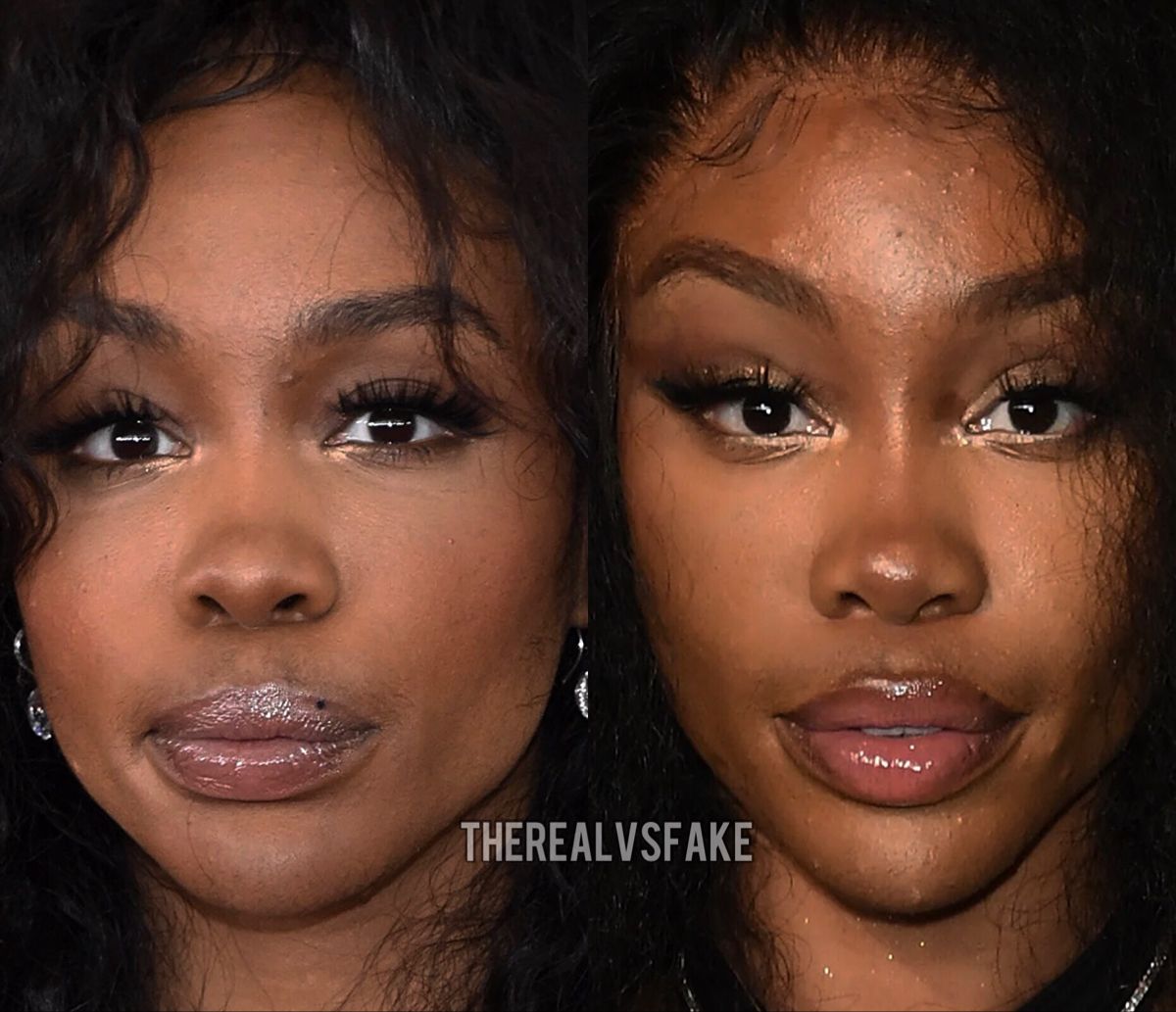 Sza Plastic Surgery Face