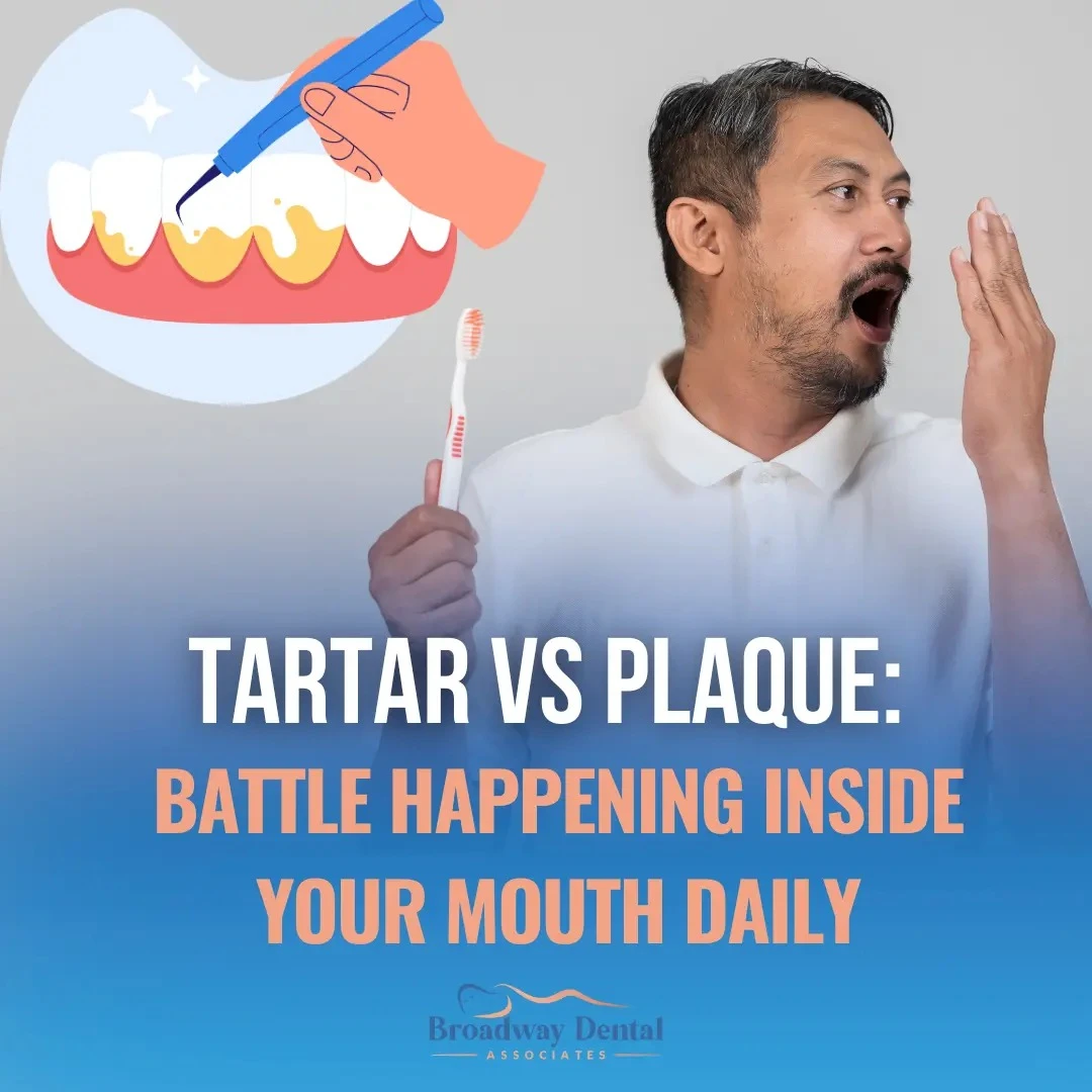 Tartar Vs Plaque