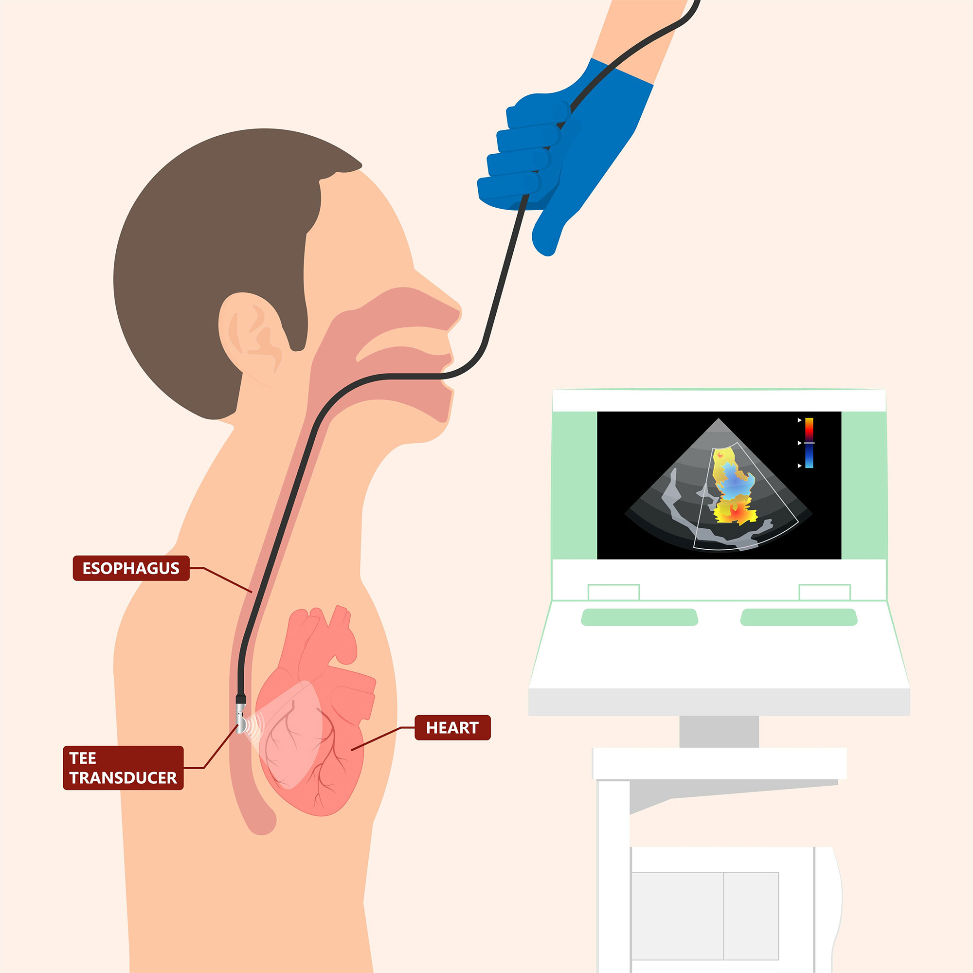 Tee Echocardiography Test