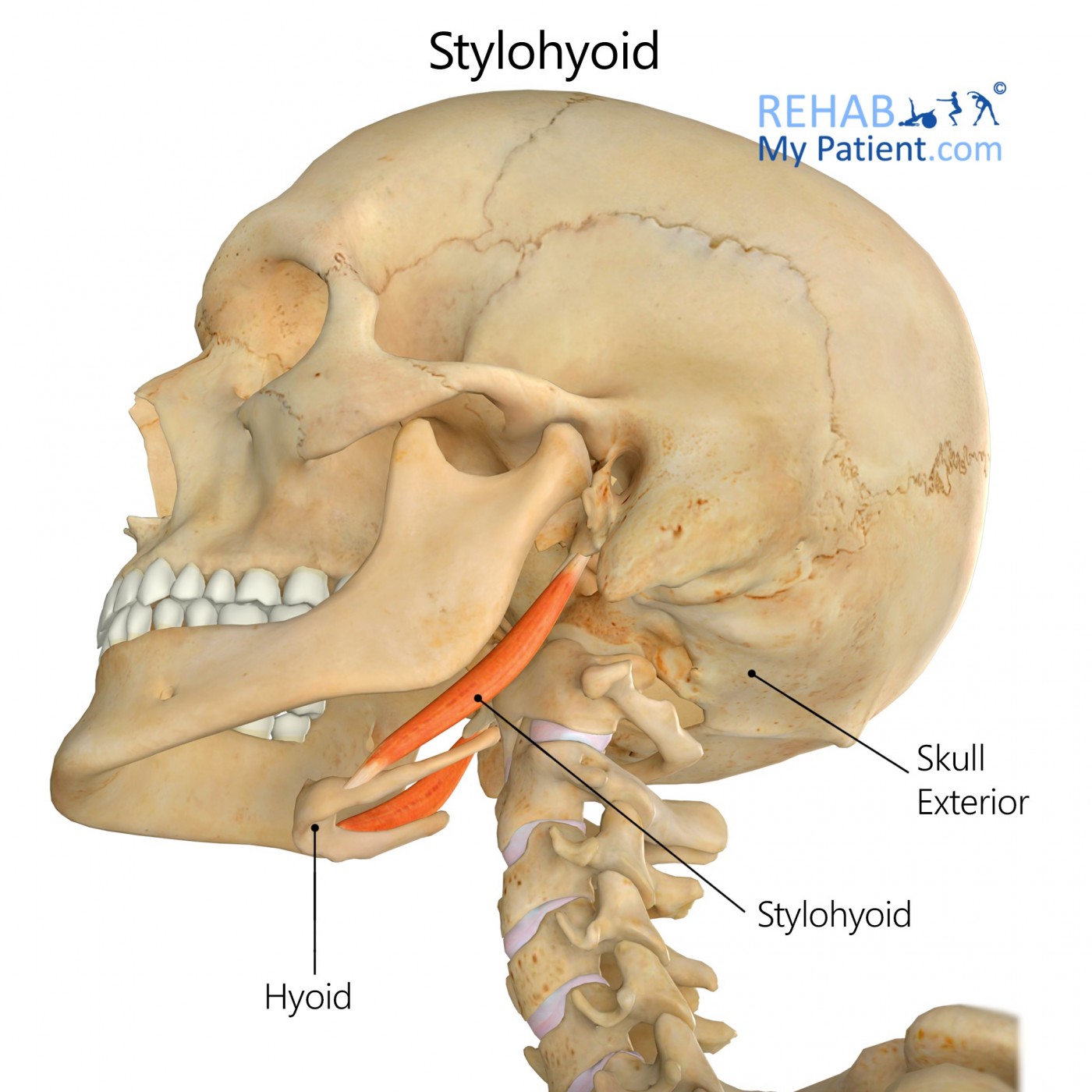 Temporal Styloid Process