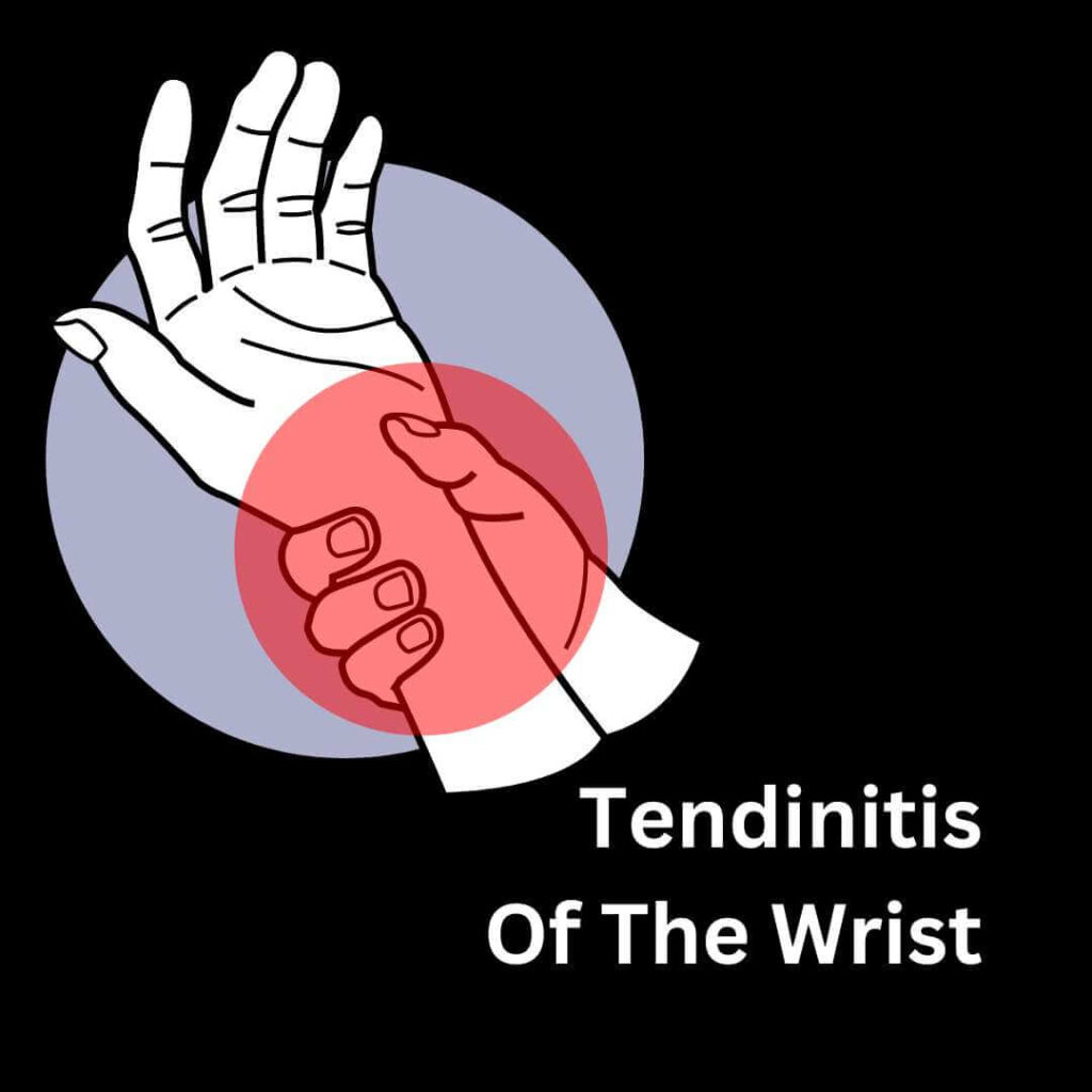 Tendinitis Of Wrist Symptoms