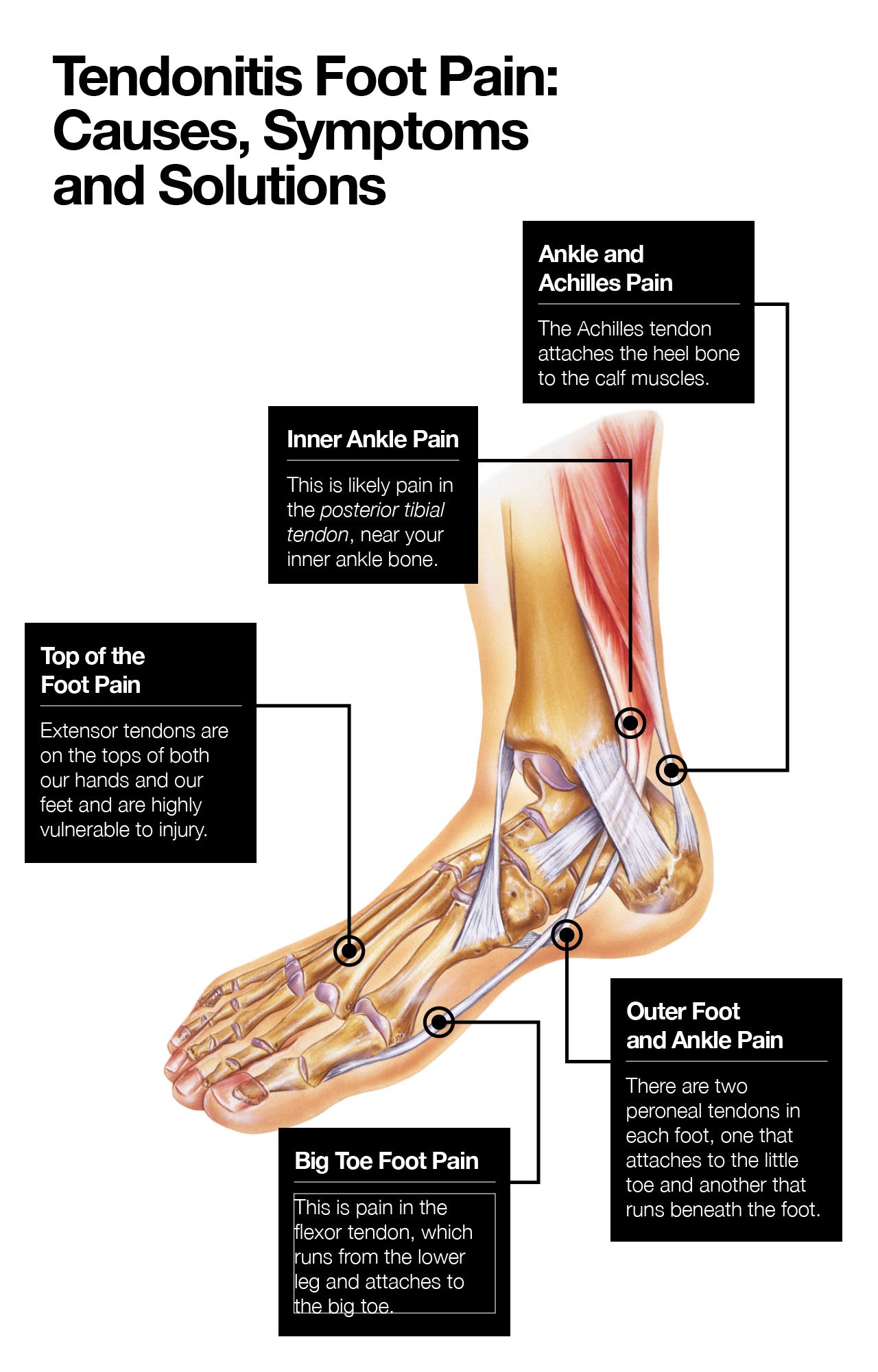 Tendonitis Top Of Foot