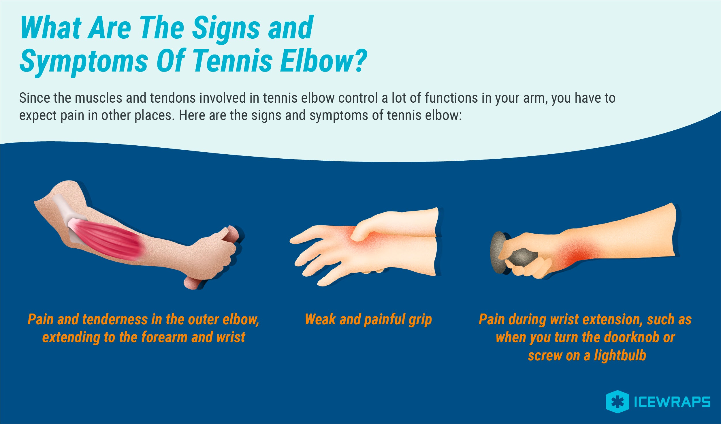 Tennis Arm Symptoms
