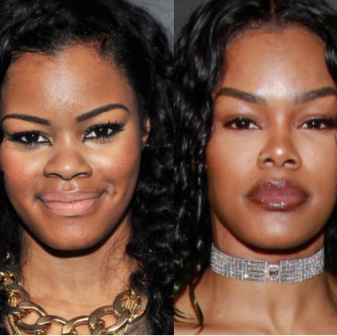 Teyana Taylor Face Surgery