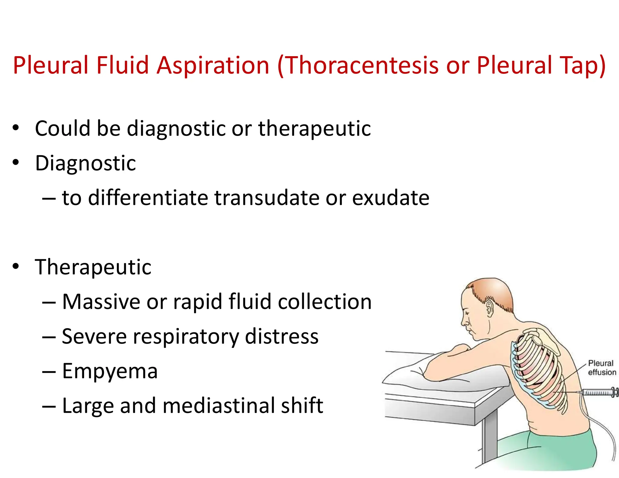 Thoracentesis Pleural Tap