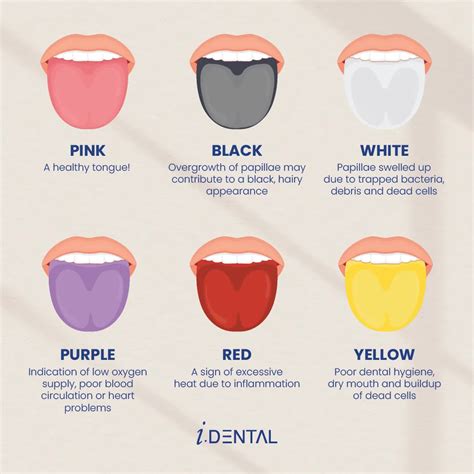 Tongue Color Meaning
