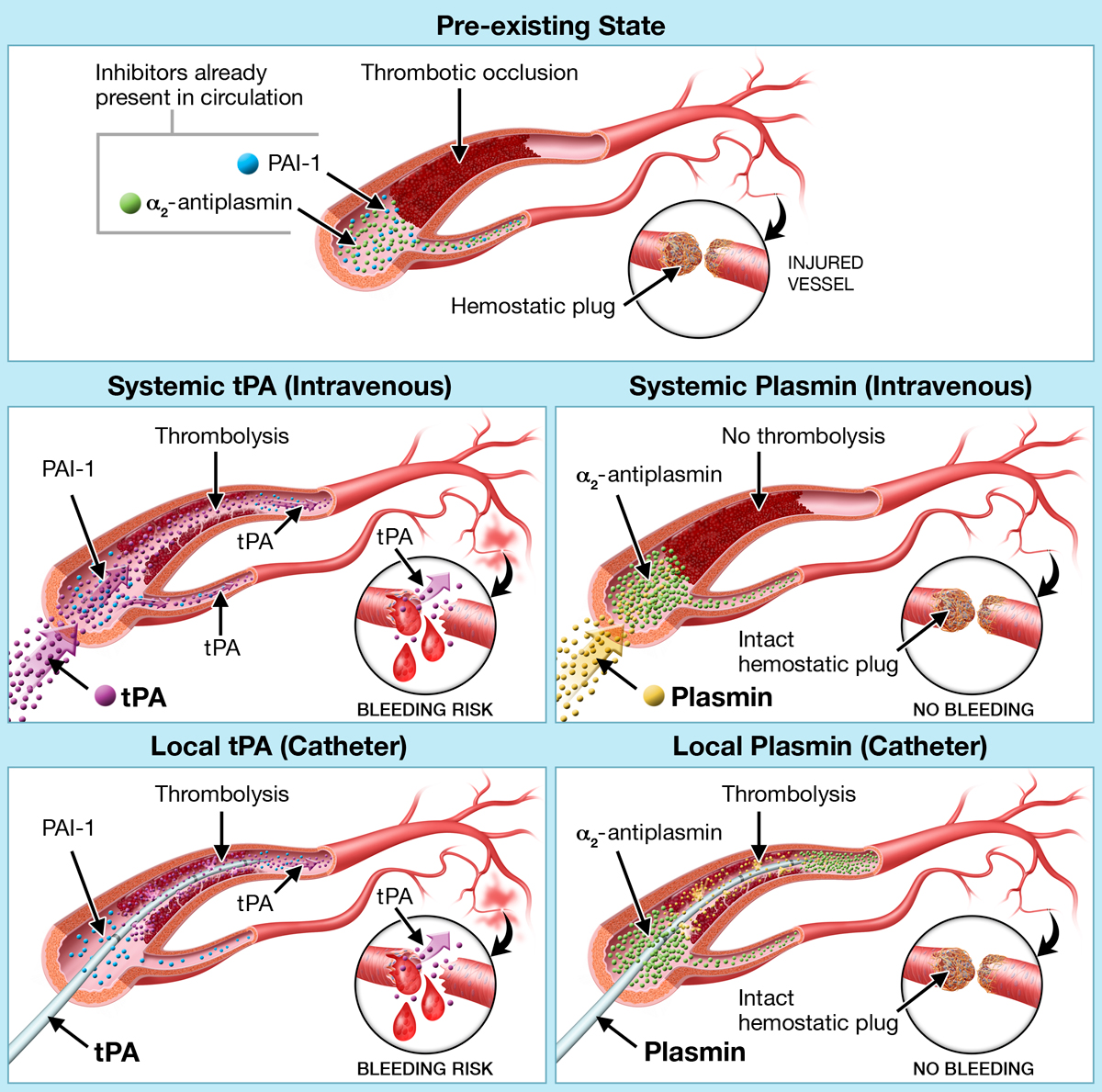 Tpa Medical Abbreviation