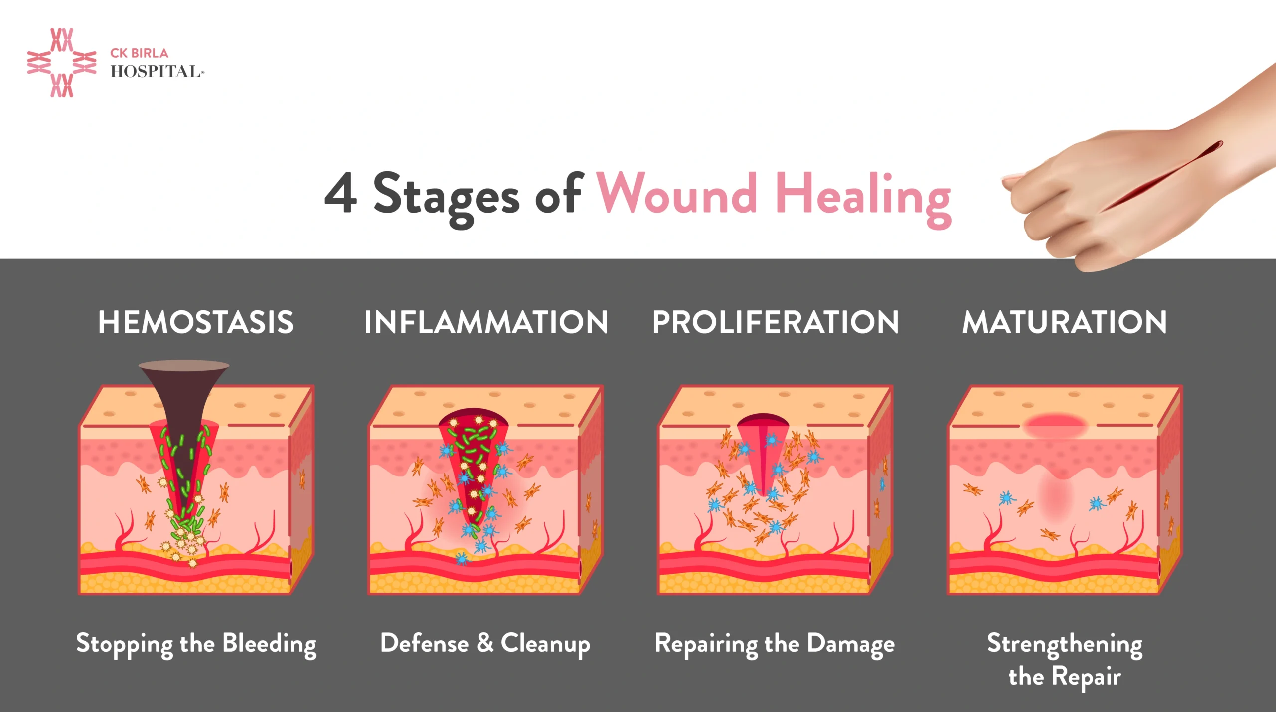 Treatment For Wound Healing