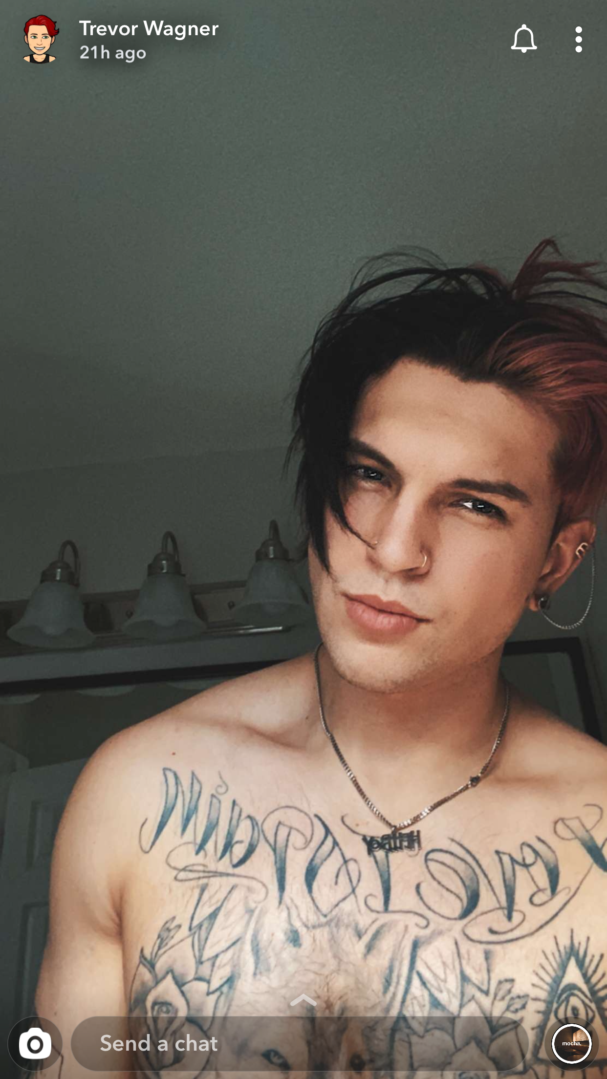 Trevor Wagner Face Surgery