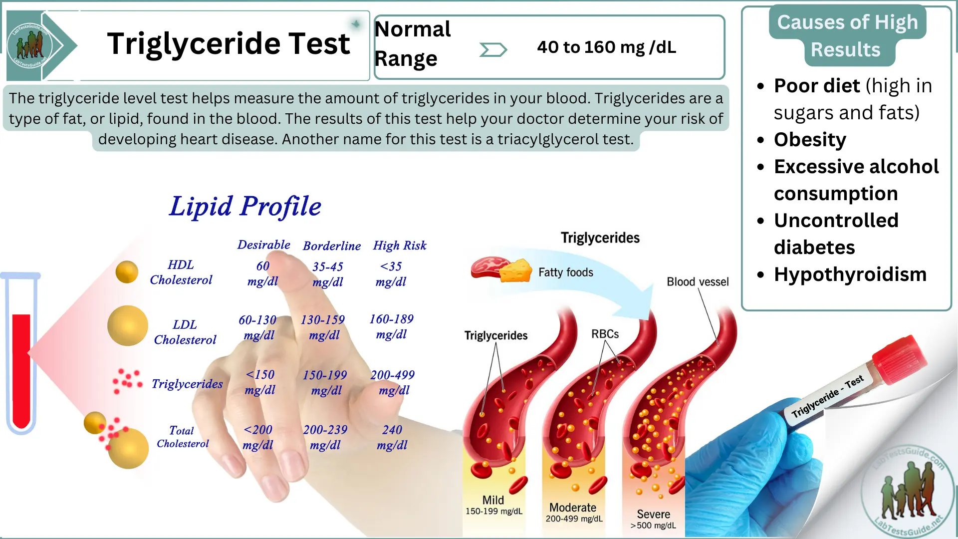 Triglycerides Laboratory Test