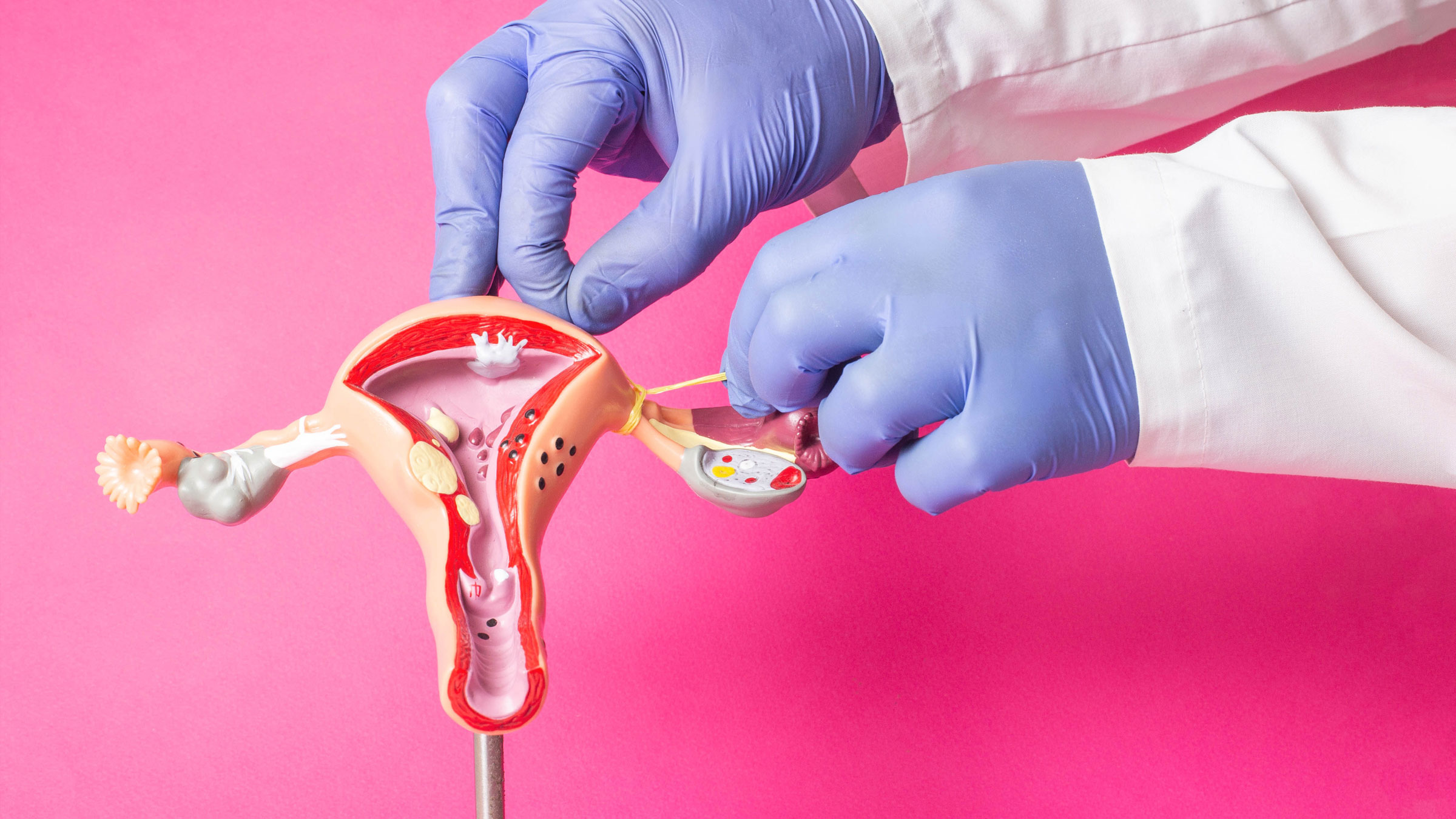 Tubal Ligation Cost