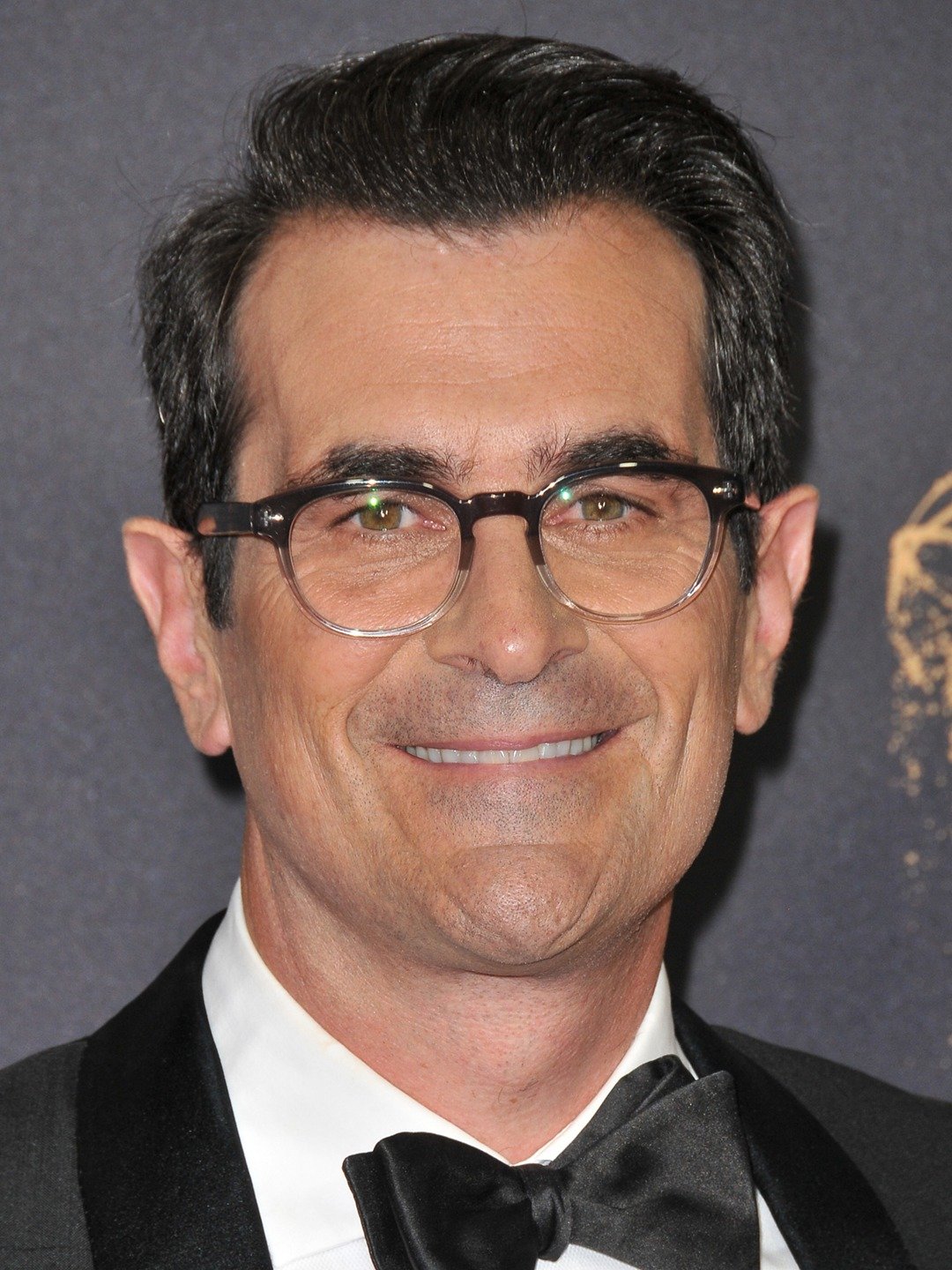 Ty Burrell Face Surgery