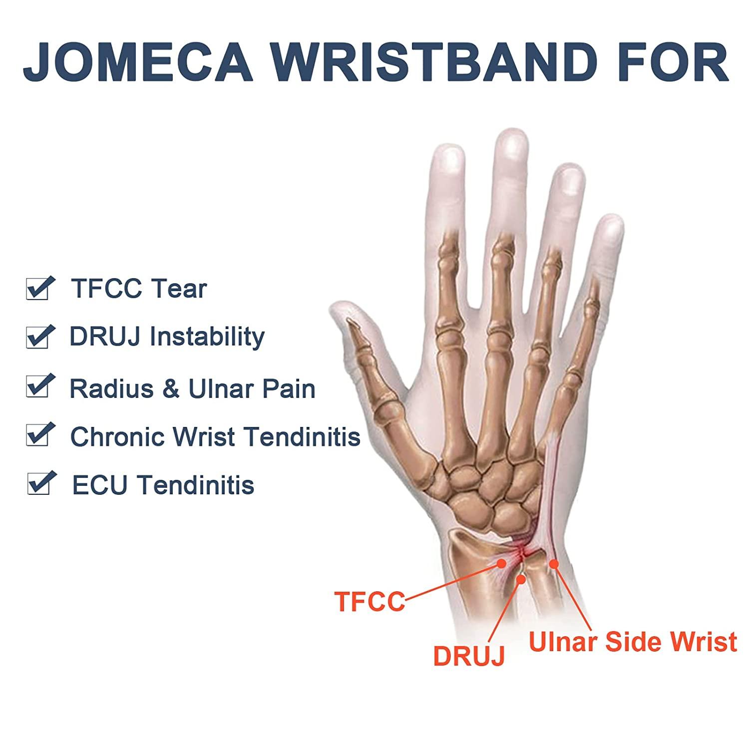 Ulnar Wrist Pain