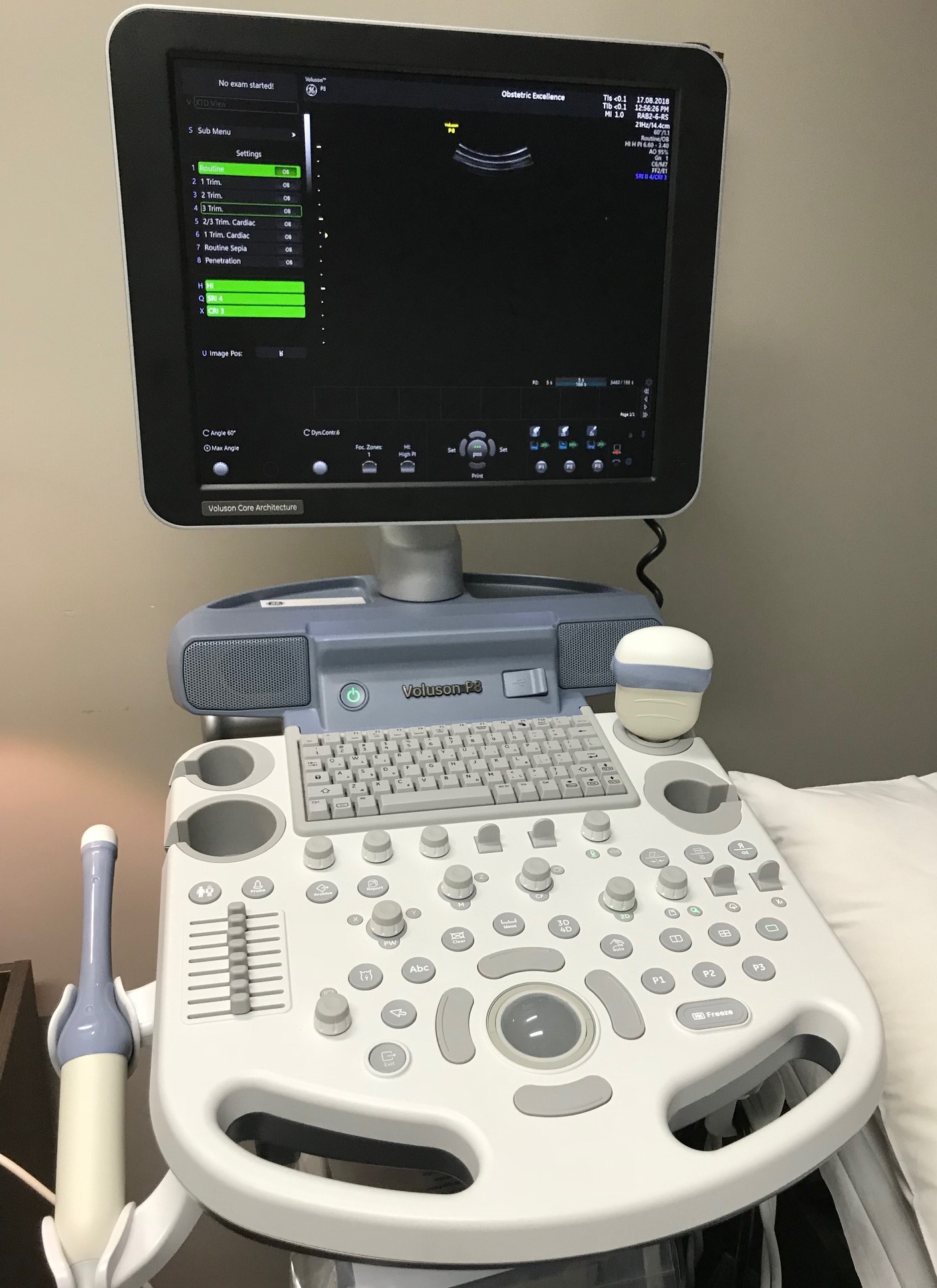 Ultrasound Machine