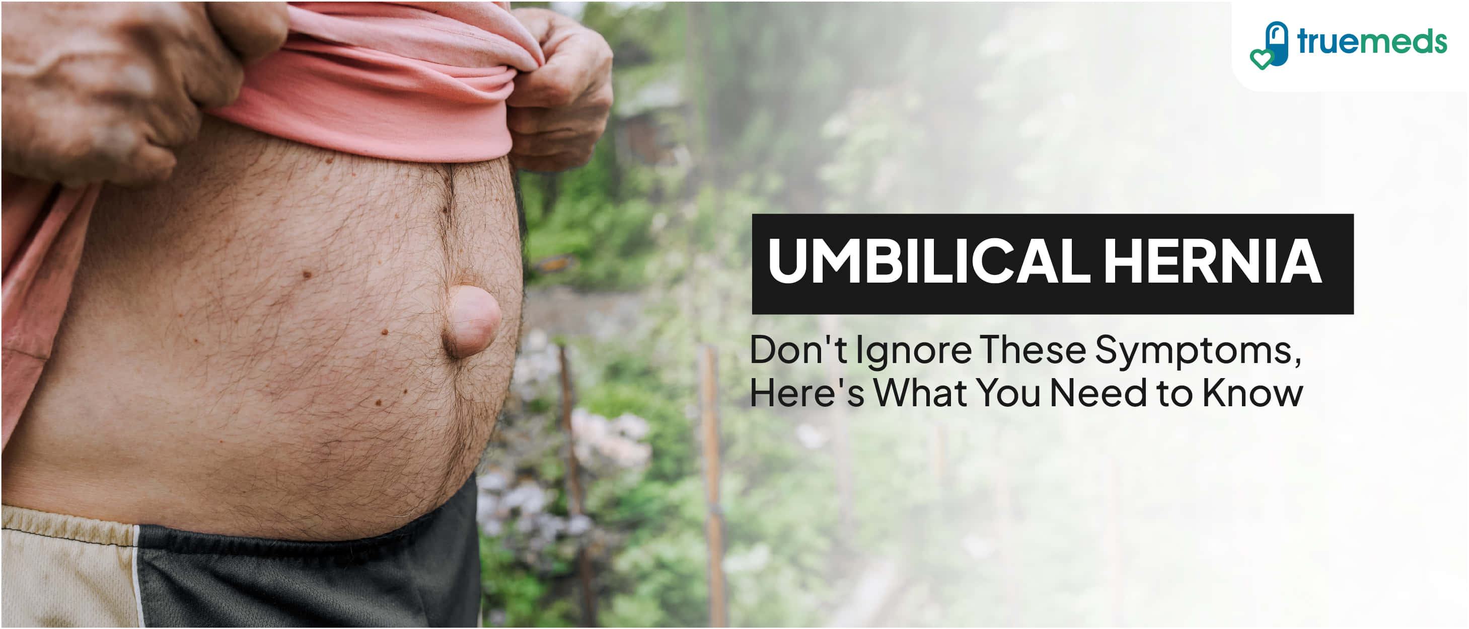 Umbilical Hernia In Adults