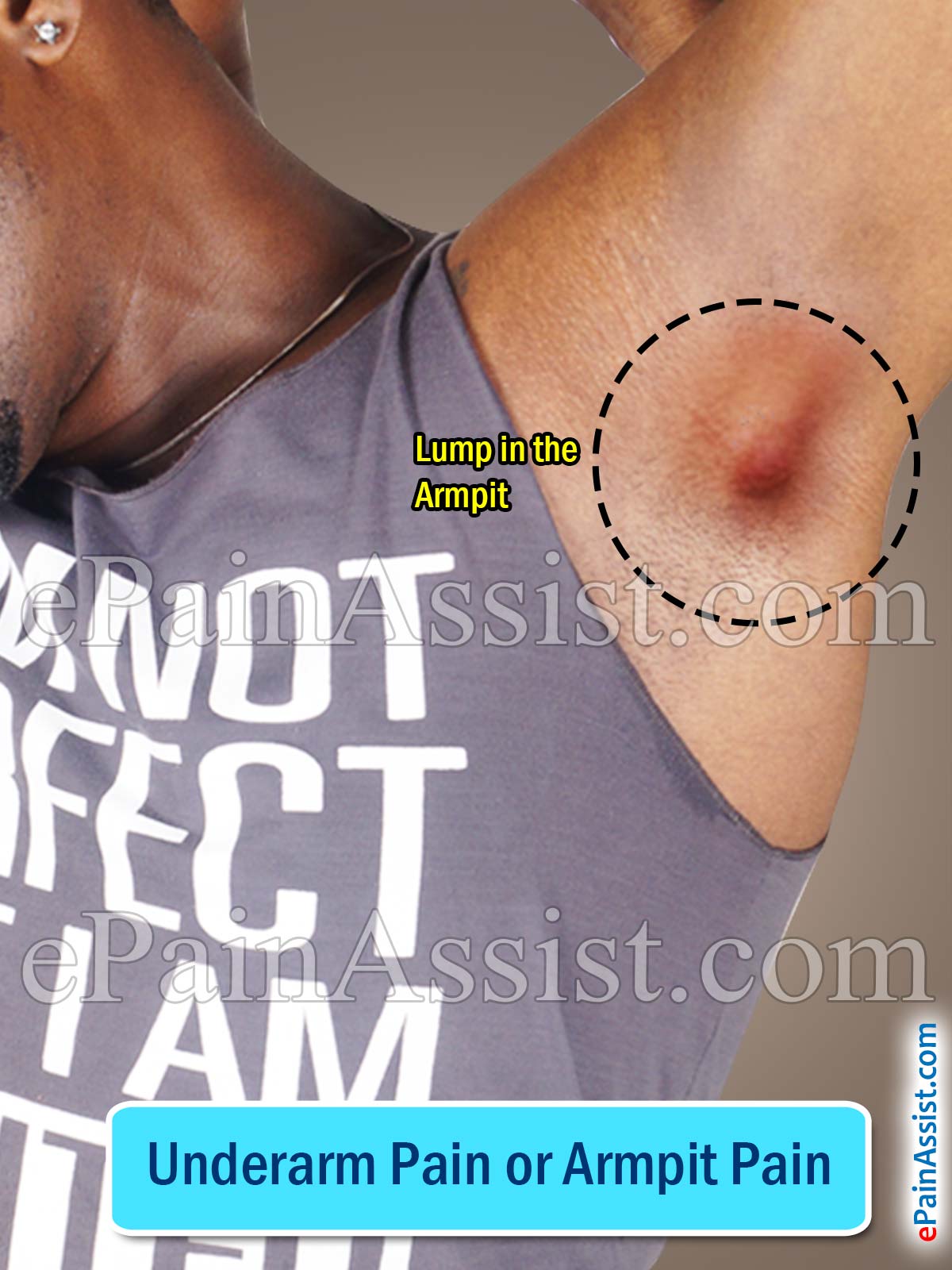 Under Arm Pain