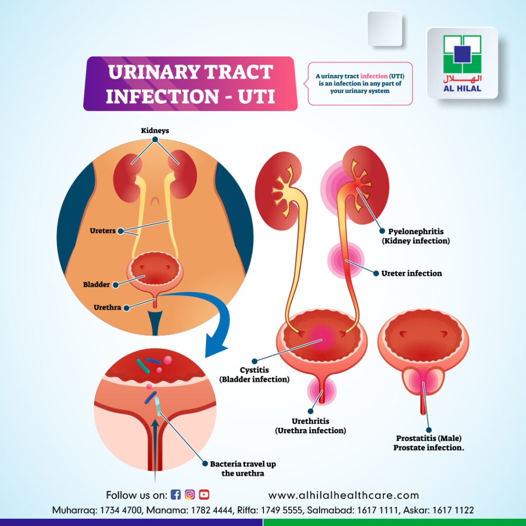 Urinary Tract Infection Specialists