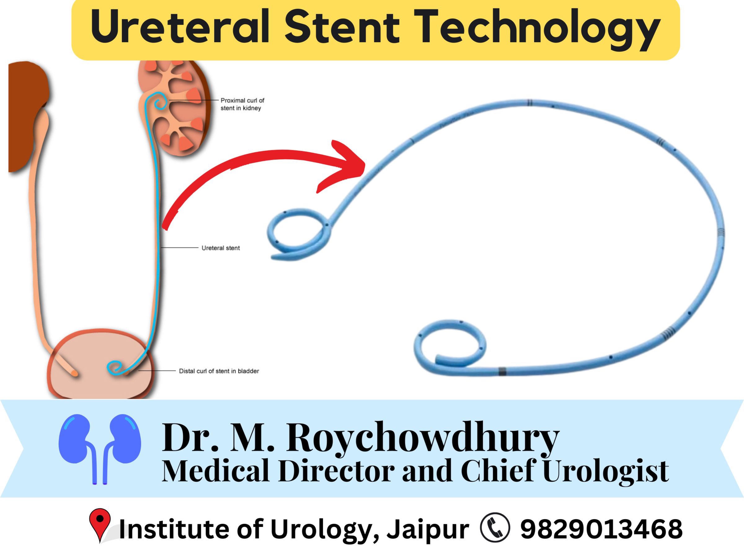 Urinary Tract Stent Procedure
