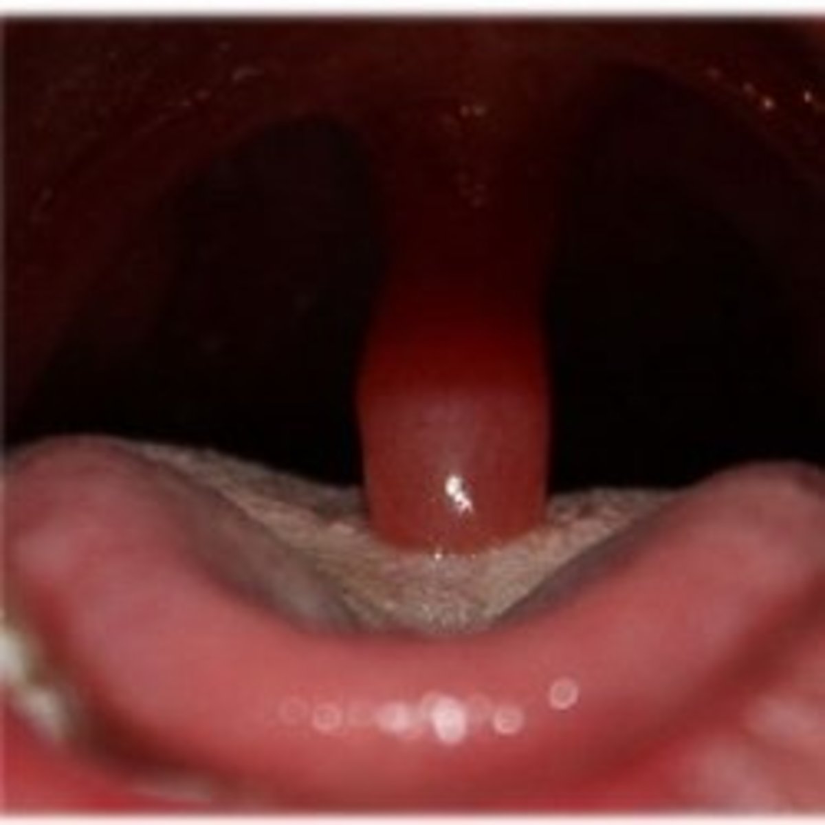 Uvula Touching Tongue