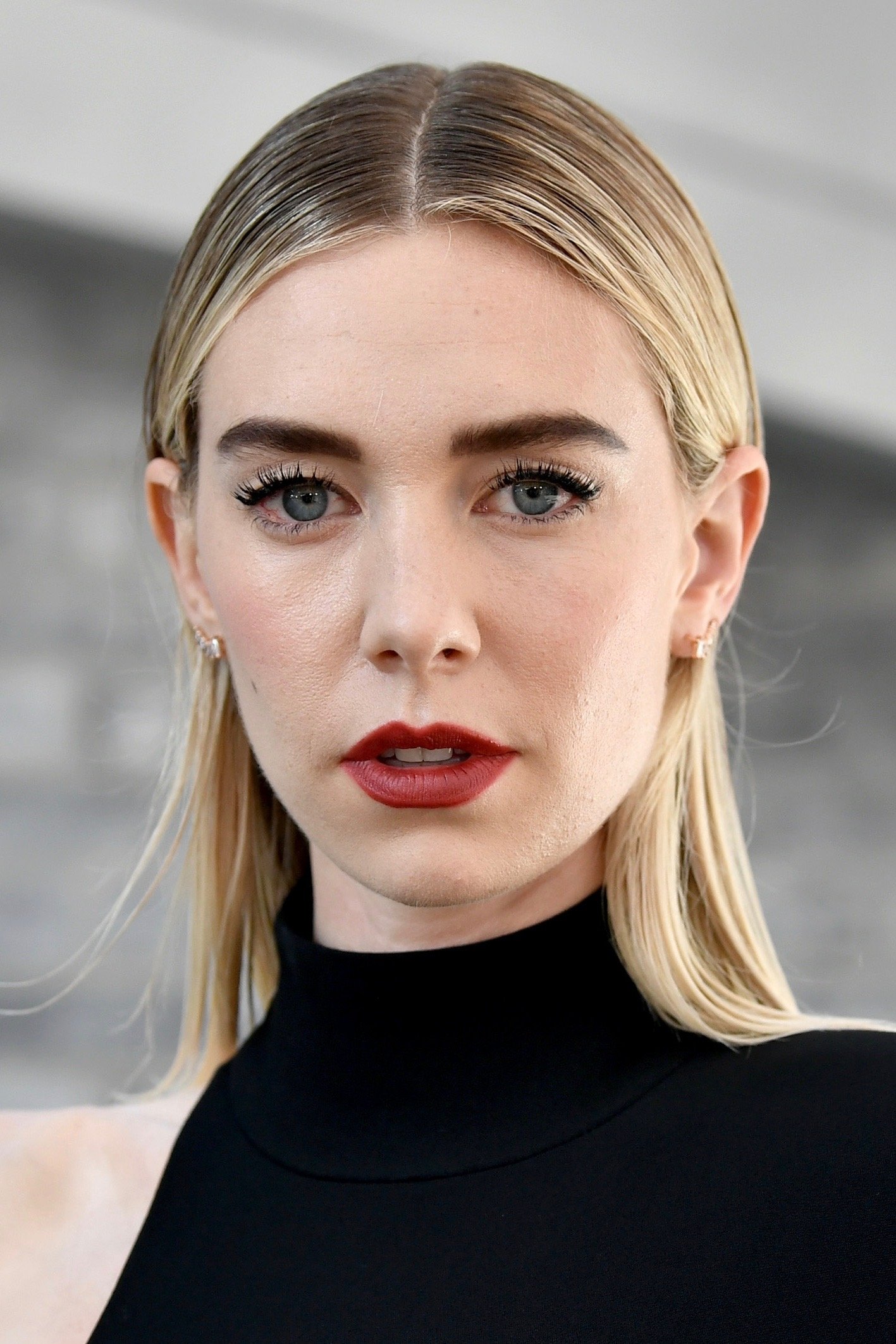 Vanessa Kirby Face Surgery