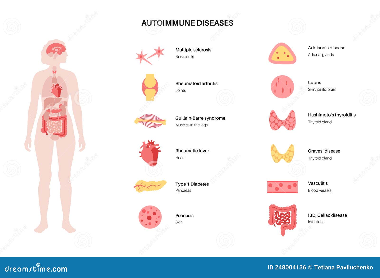 Vasculitis And Autoimmune Diseases