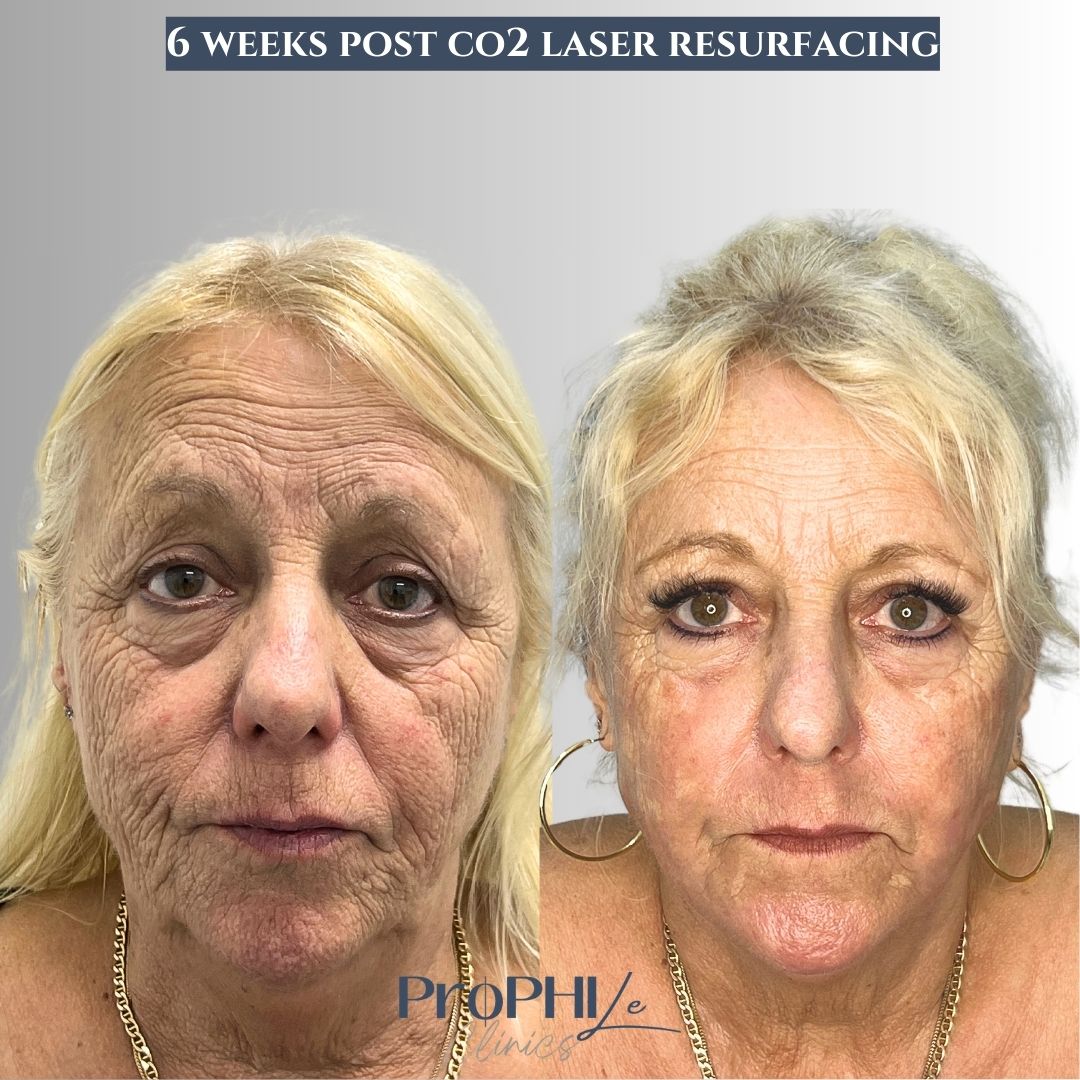 Vita Celestine Onlyfans Leaks