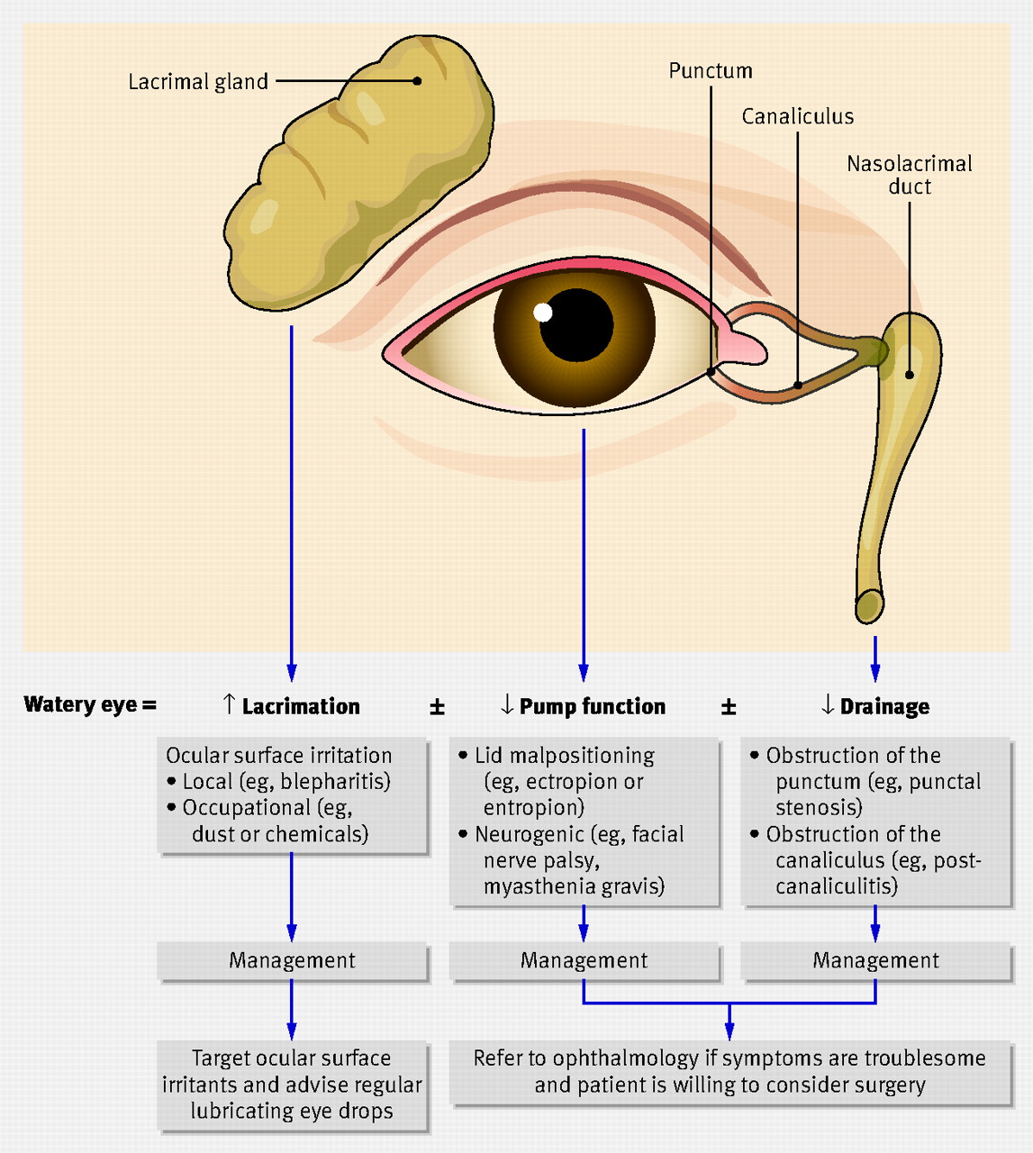 Watery Eyes Medical Term
