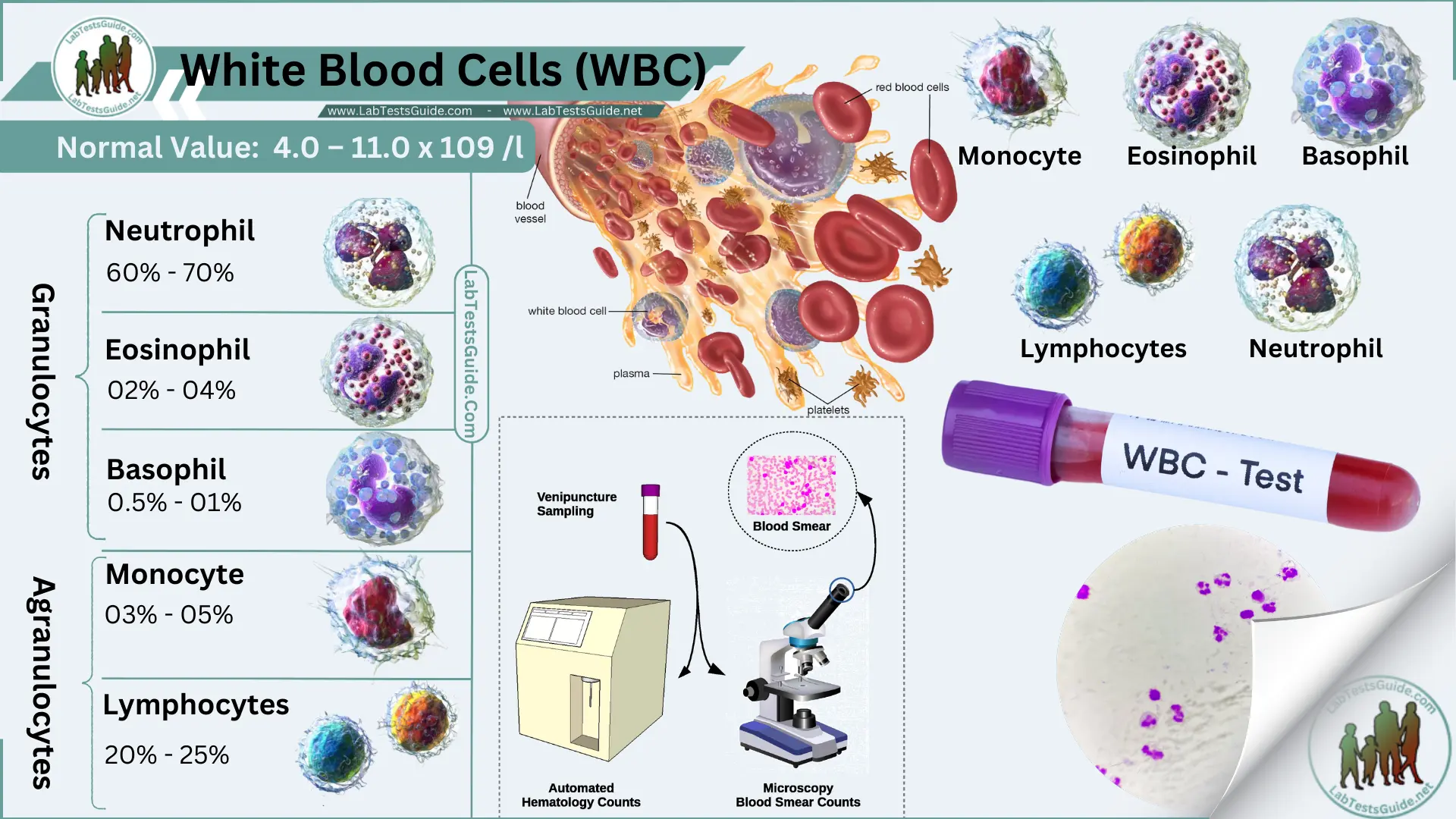 Wbc Laboratory Test