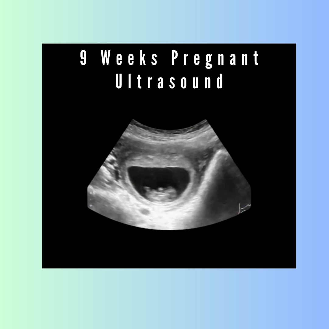Week 9 Pregnancy